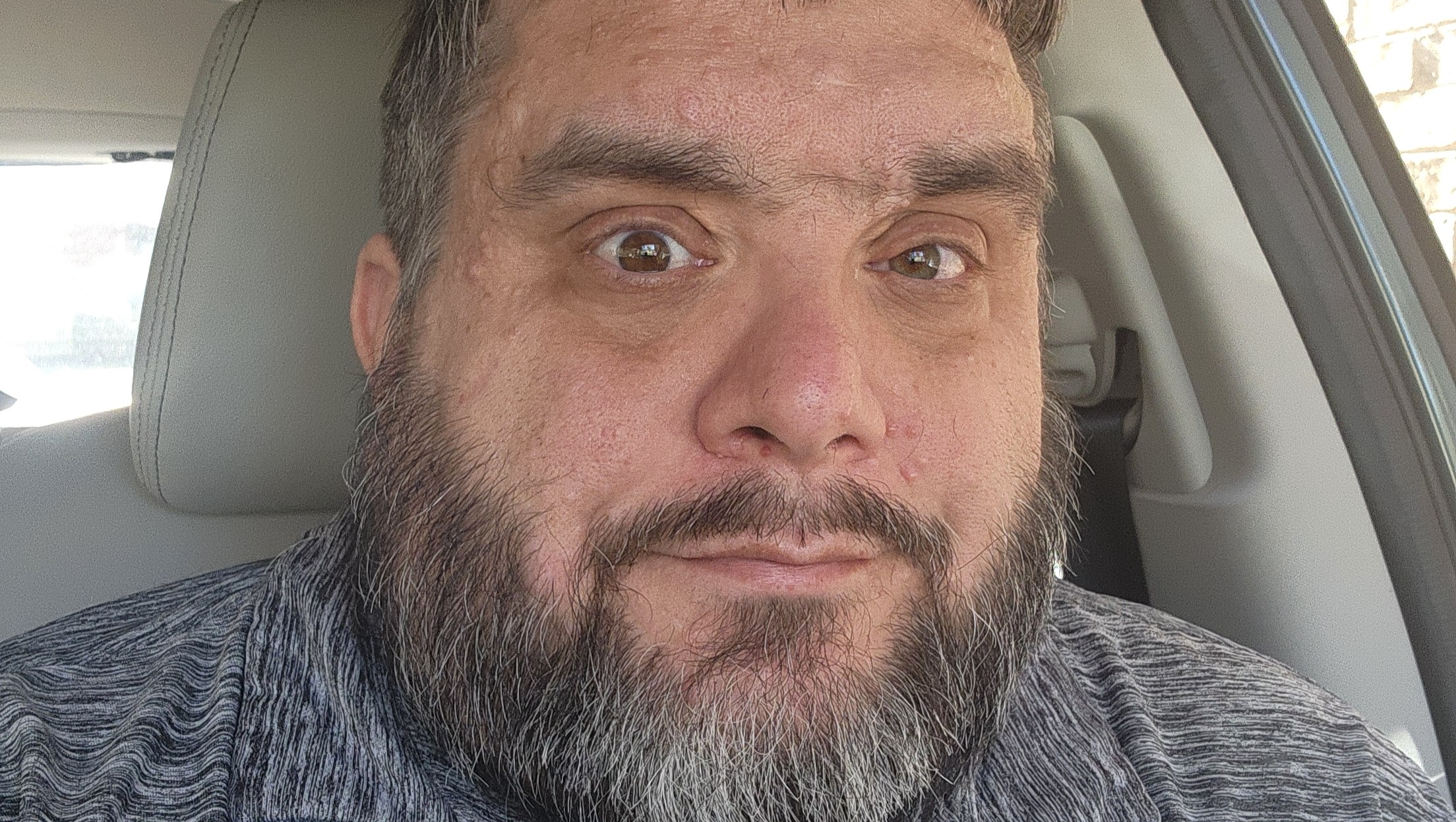 Help William Cover Kidney Procedure Costs