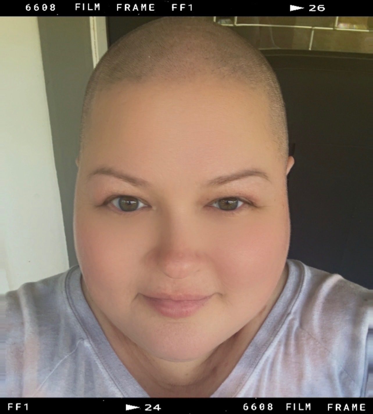 Support Allison’s Breast Cancer Journey campaign photo, 5 of 8