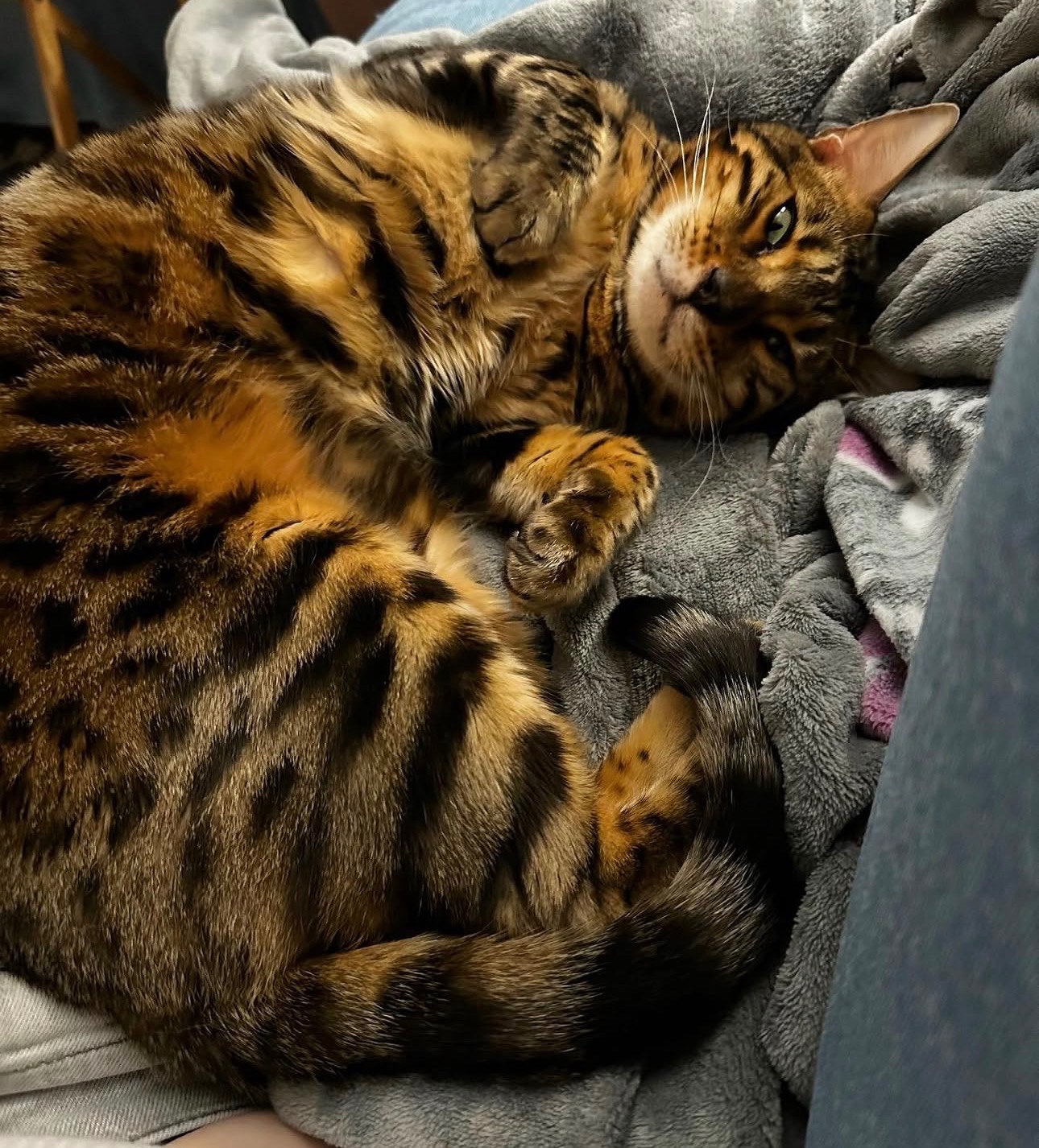 Support Babou’s Healing Journey After Major Surgery campaign photo, 2 of 6
