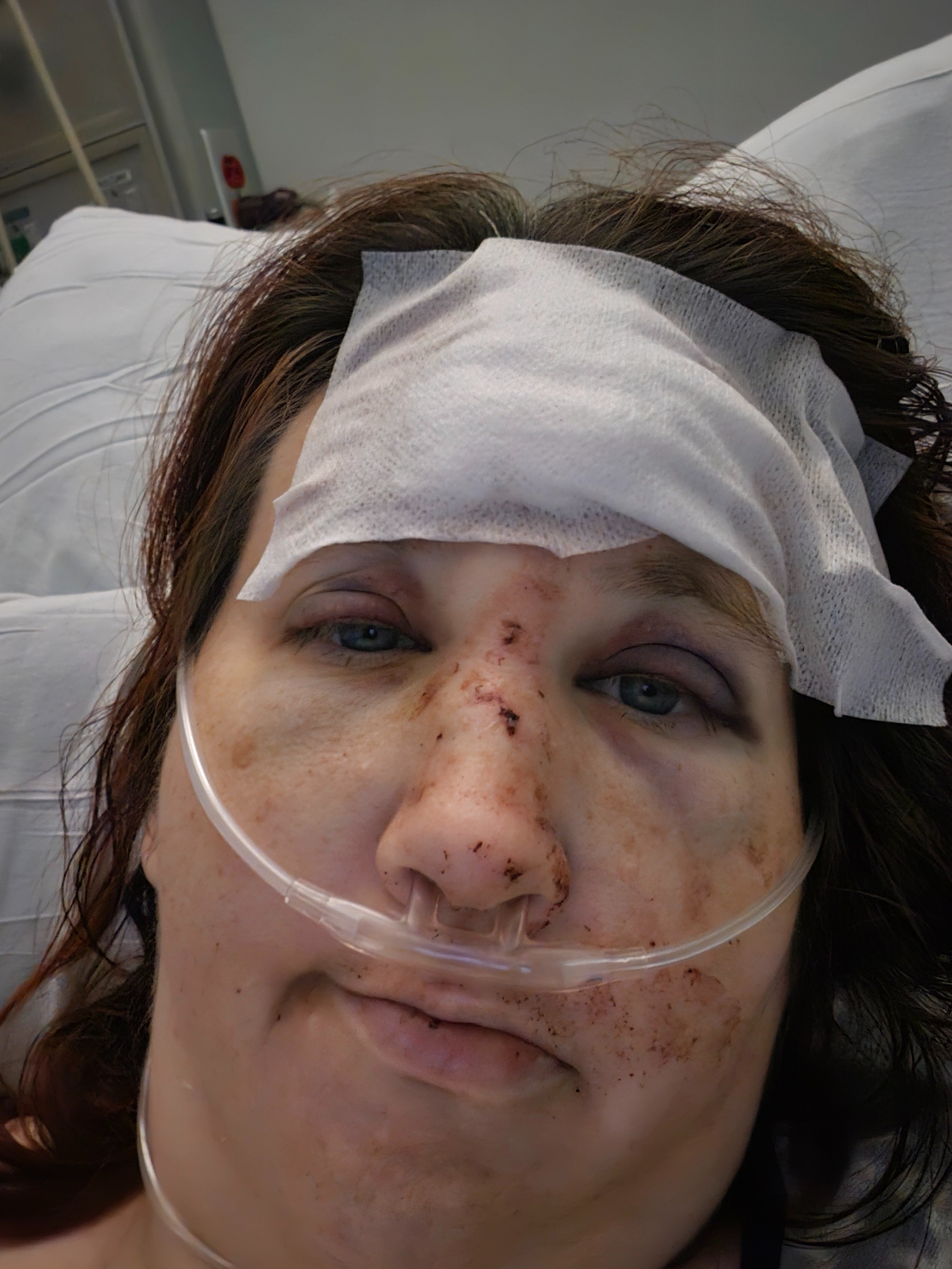 Support Corrine's Recovery After E-Bike Accident campaign photo, 5 of 8
