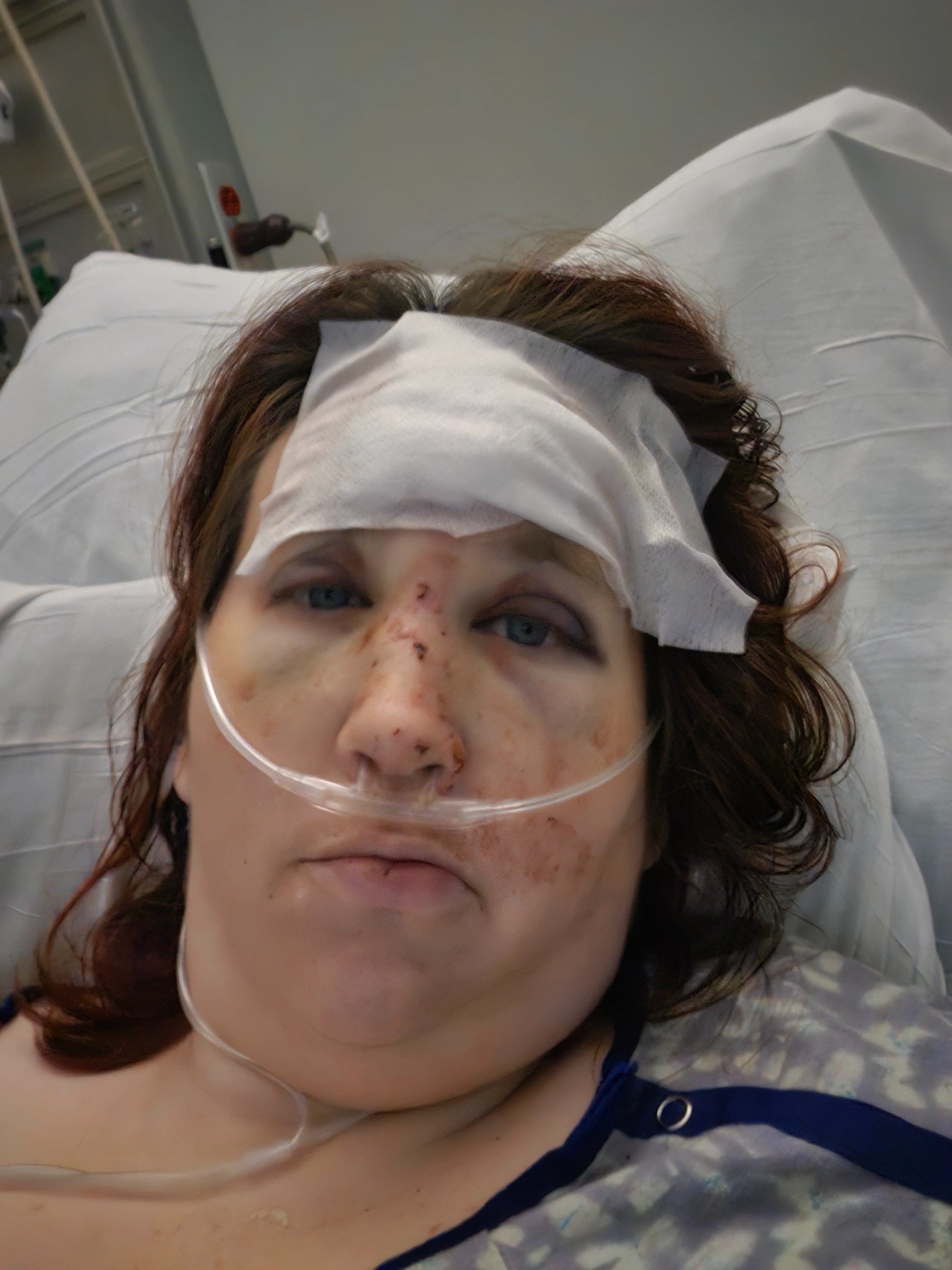 Support Corrine's Recovery After E-Bike Accident campaign photo, 4 of 8