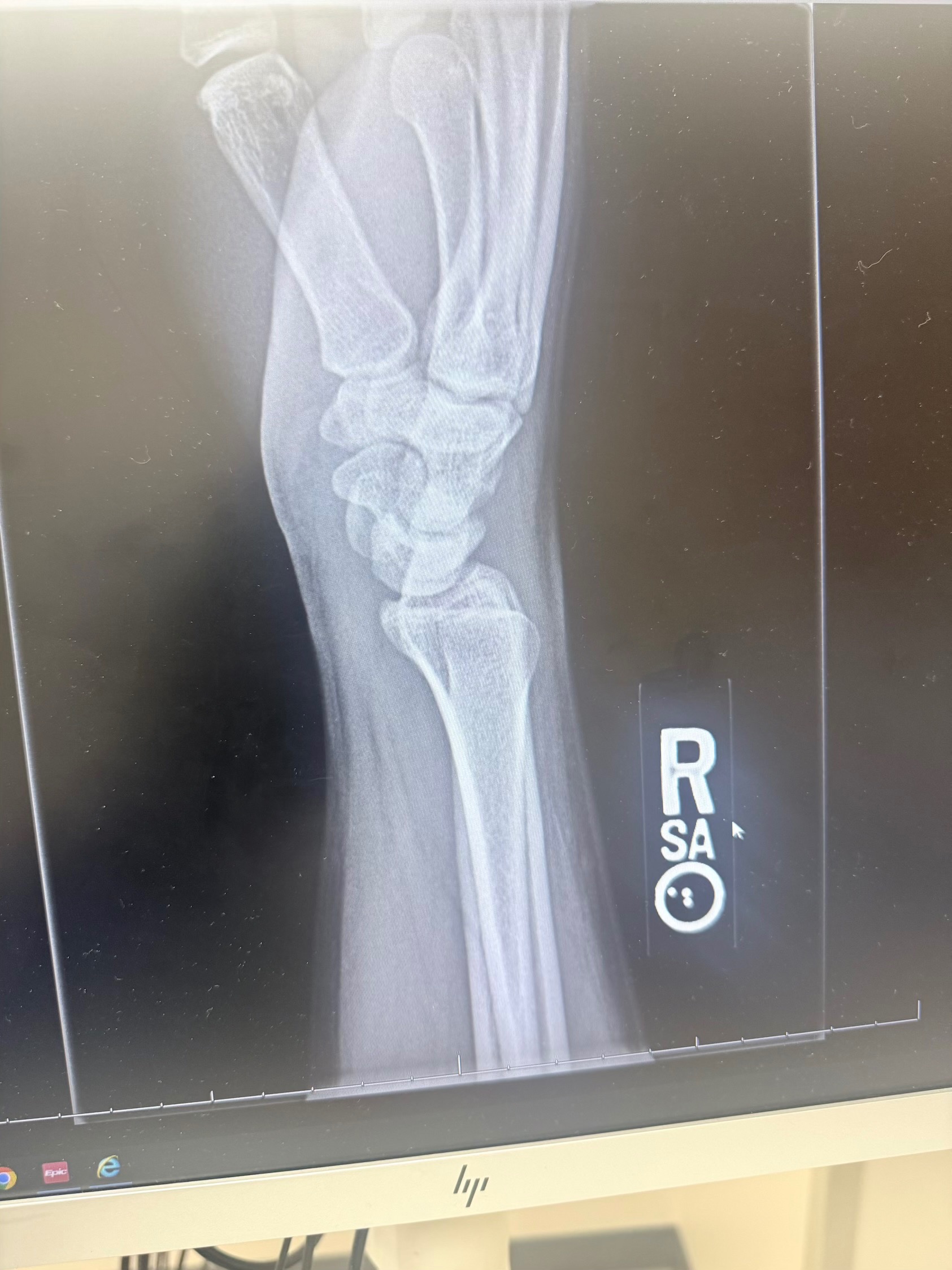 Help Me Heal and Get Back on My Feet campaign photo, 2 of 8
