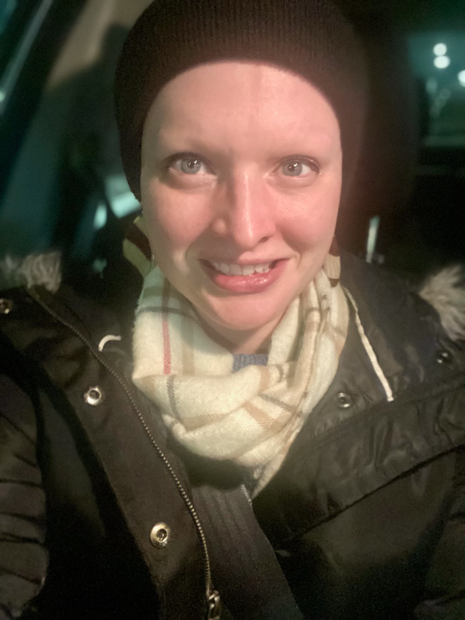 Give Allie the Gift of Eyebrows campaign photo, 2 of 5