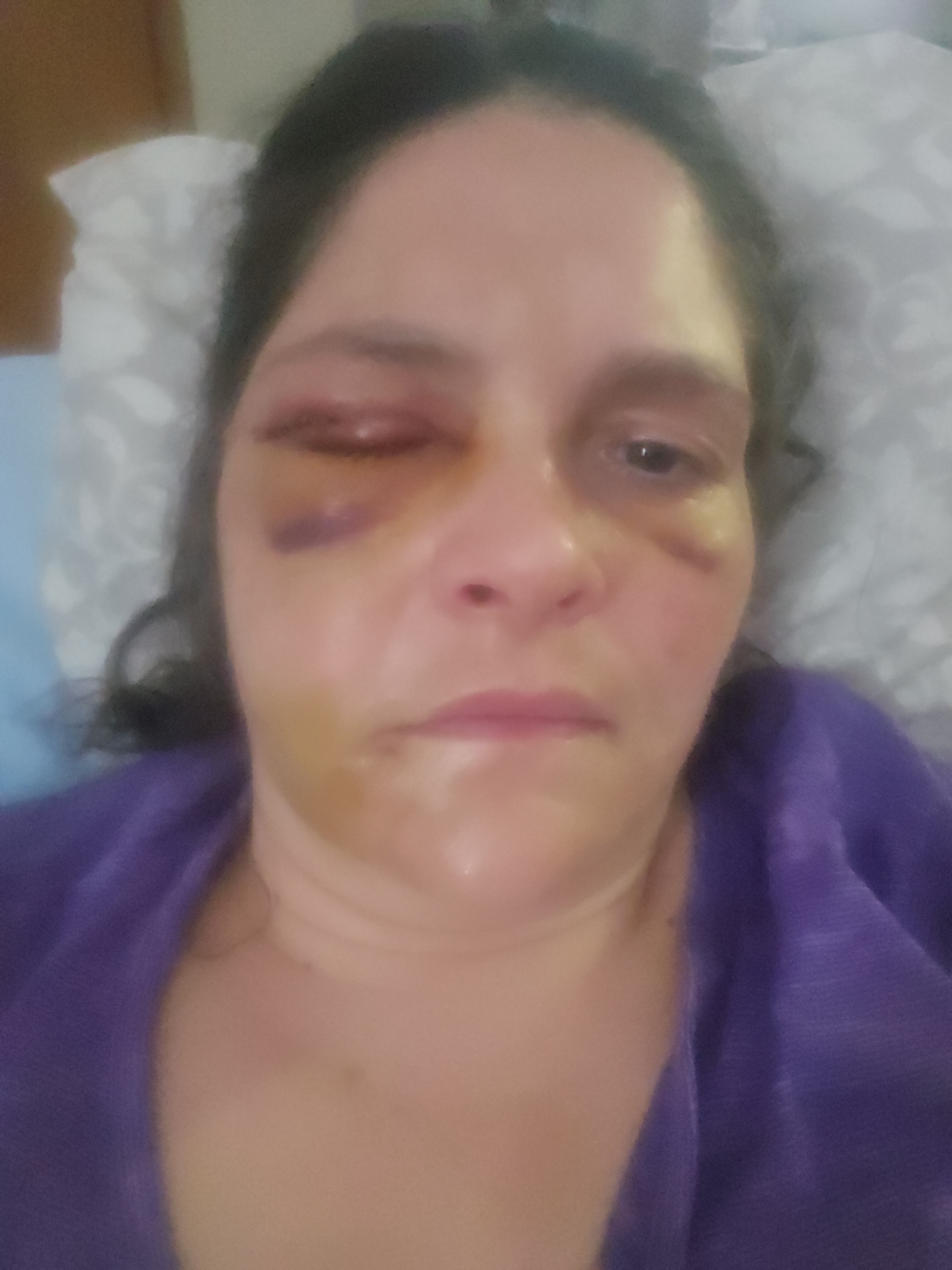 Help Laura & Son Stay Safe After Assault campaign photo, 2 of 3