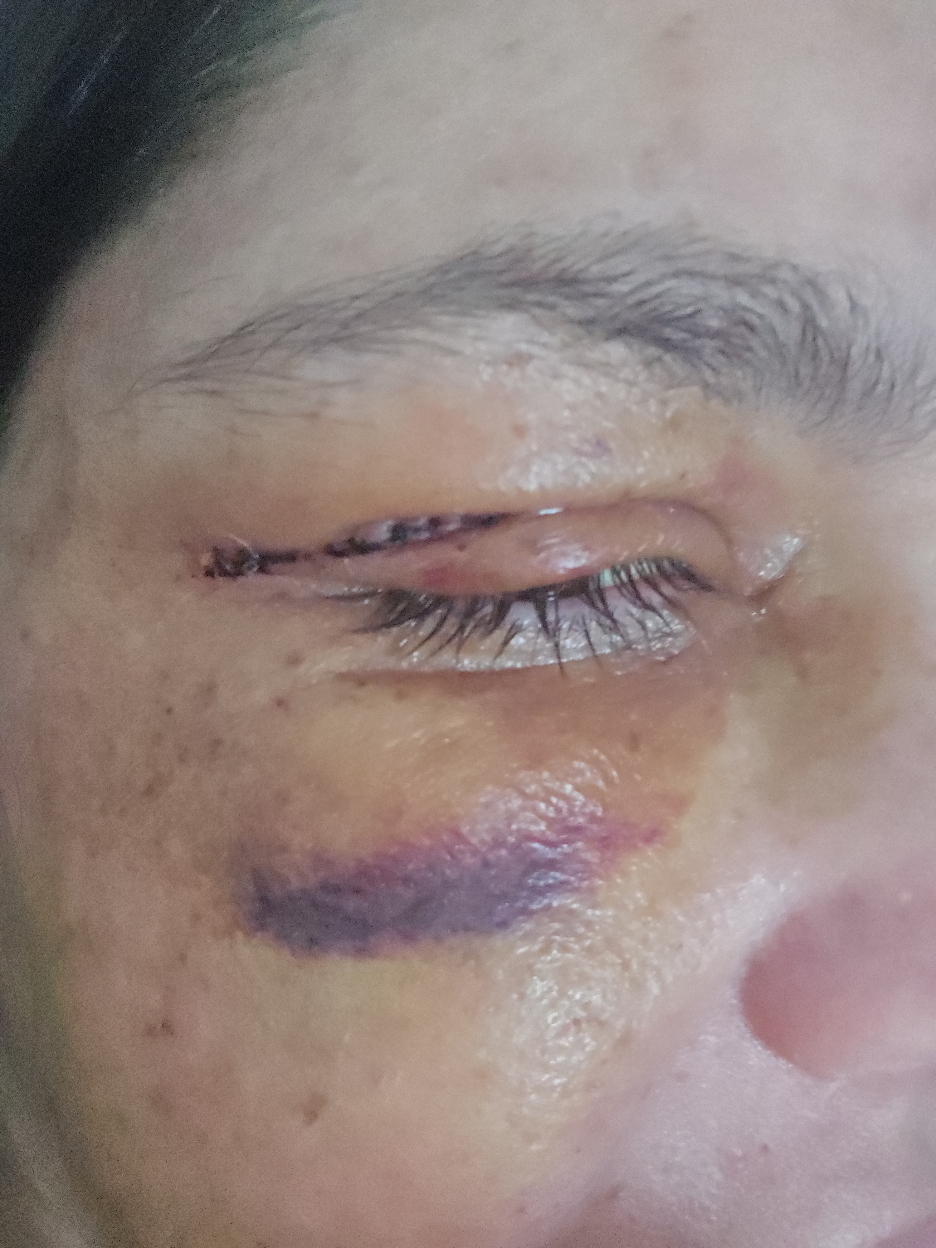 Help Laura & Son Stay Safe After Assault campaign photo, 1 of 3