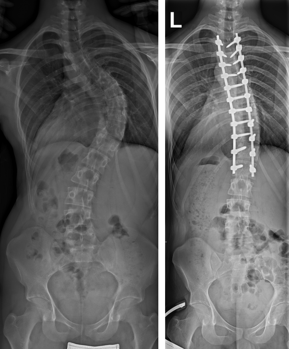 Ohne Hilfe am Ende: Kampf gegen Schmerzen und Depressionen campaign photo, 2 of 4