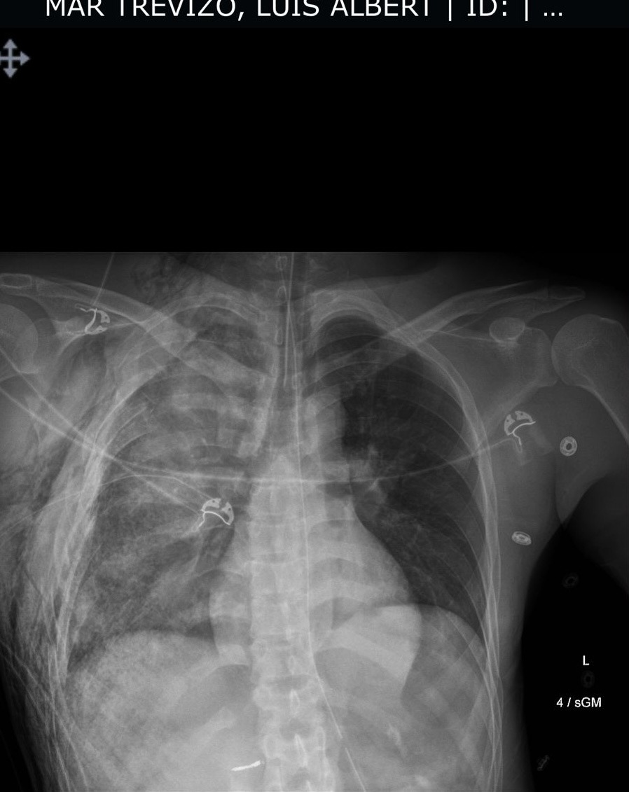 Support Luis in his fight to recover campaign photo, 4 of 6