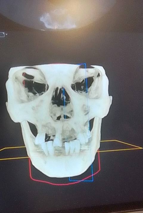Help Restore a Young Man’s Smile and Health campaign photo, 4 of 6