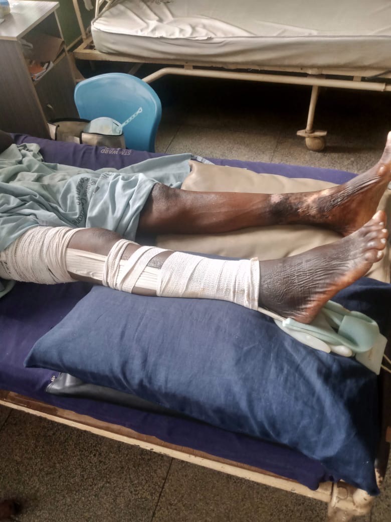 Urgent Total Hip Replacement Surgery-Support Olumuyiwa campaign photo, 4 of 6