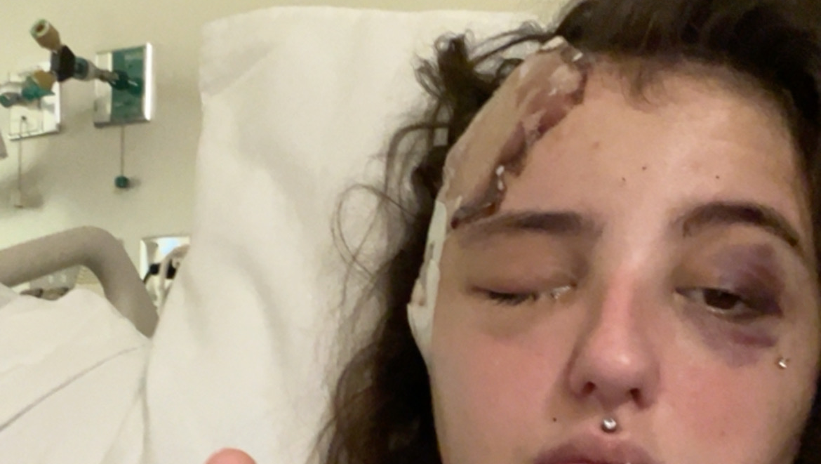 Standing with a Brave Teen After Sacramento Attack photo