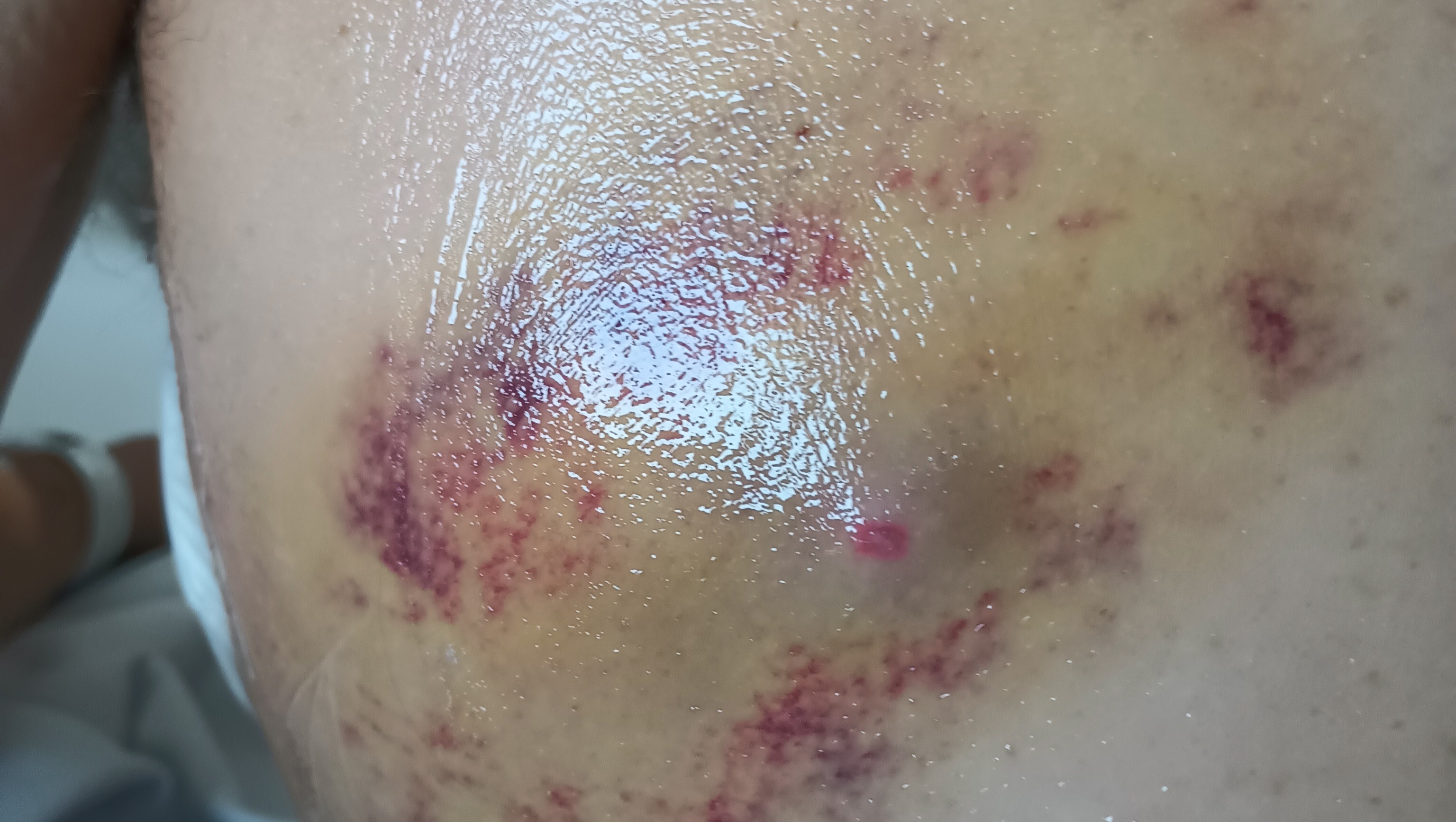 Help Blare Recover & Find Justice After Shooting photo