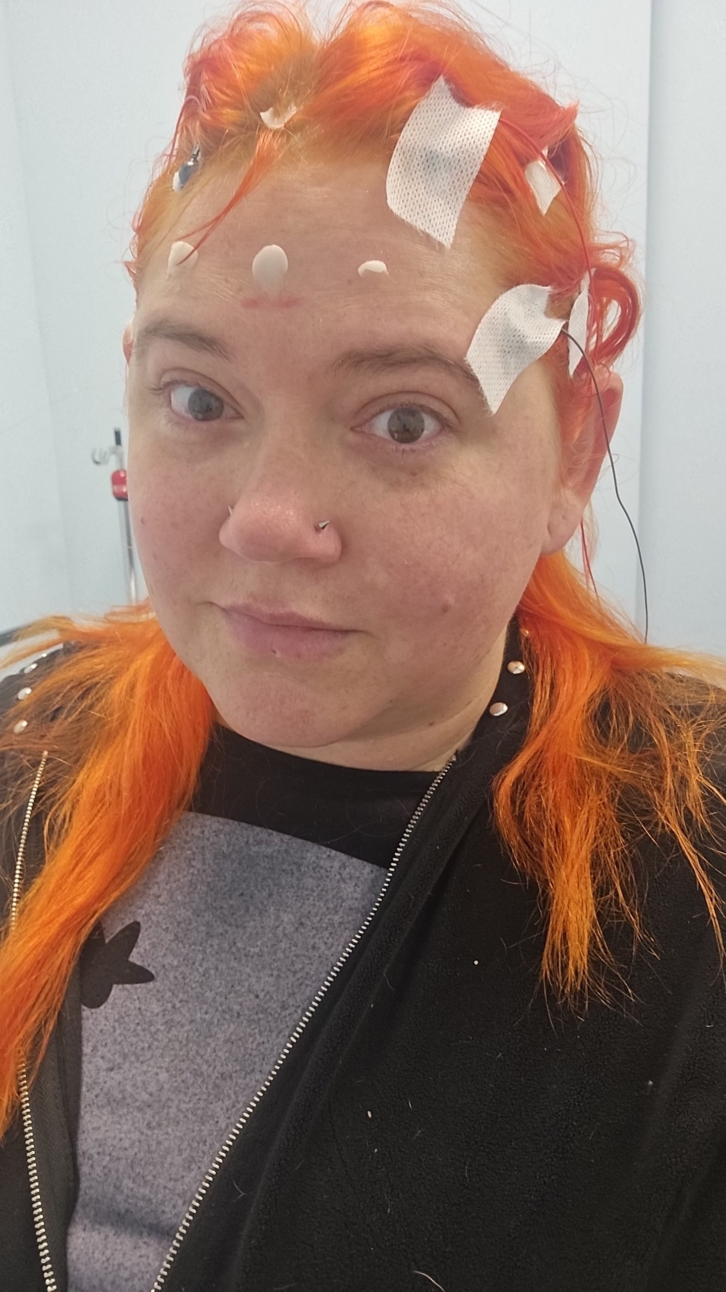 Help With Surgery & Recovery Expenses campaign photo, 4 of 7