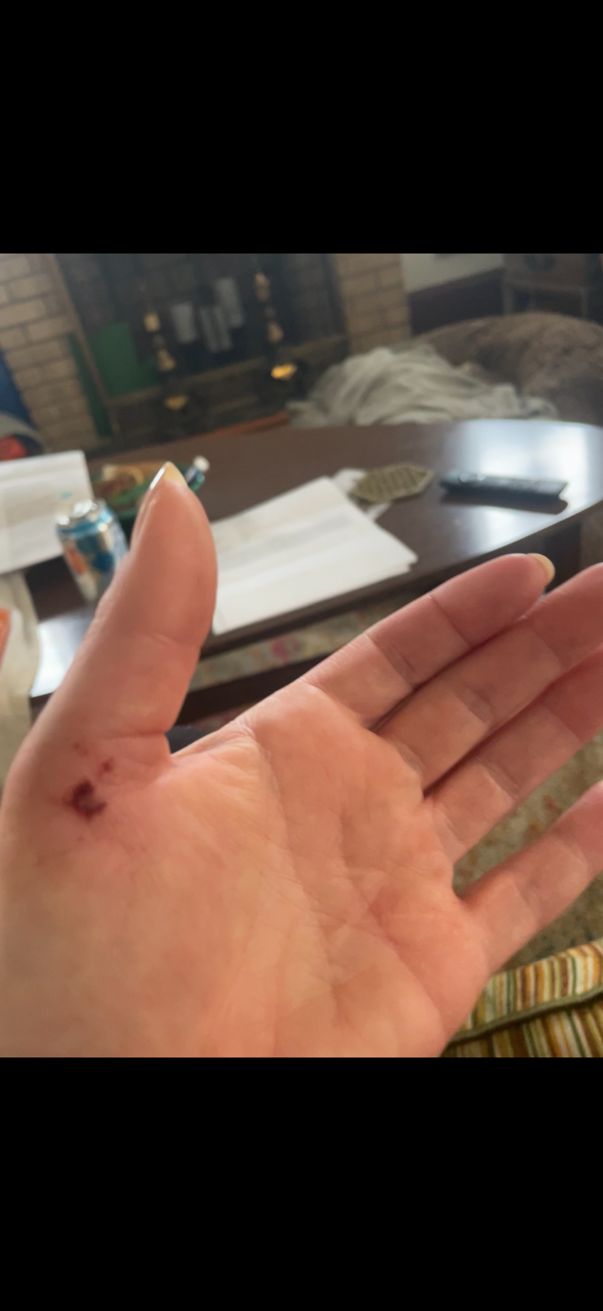Help Danielle and Yogi Heal After Vicious Dog Attack campaign photo, 2 of 8
