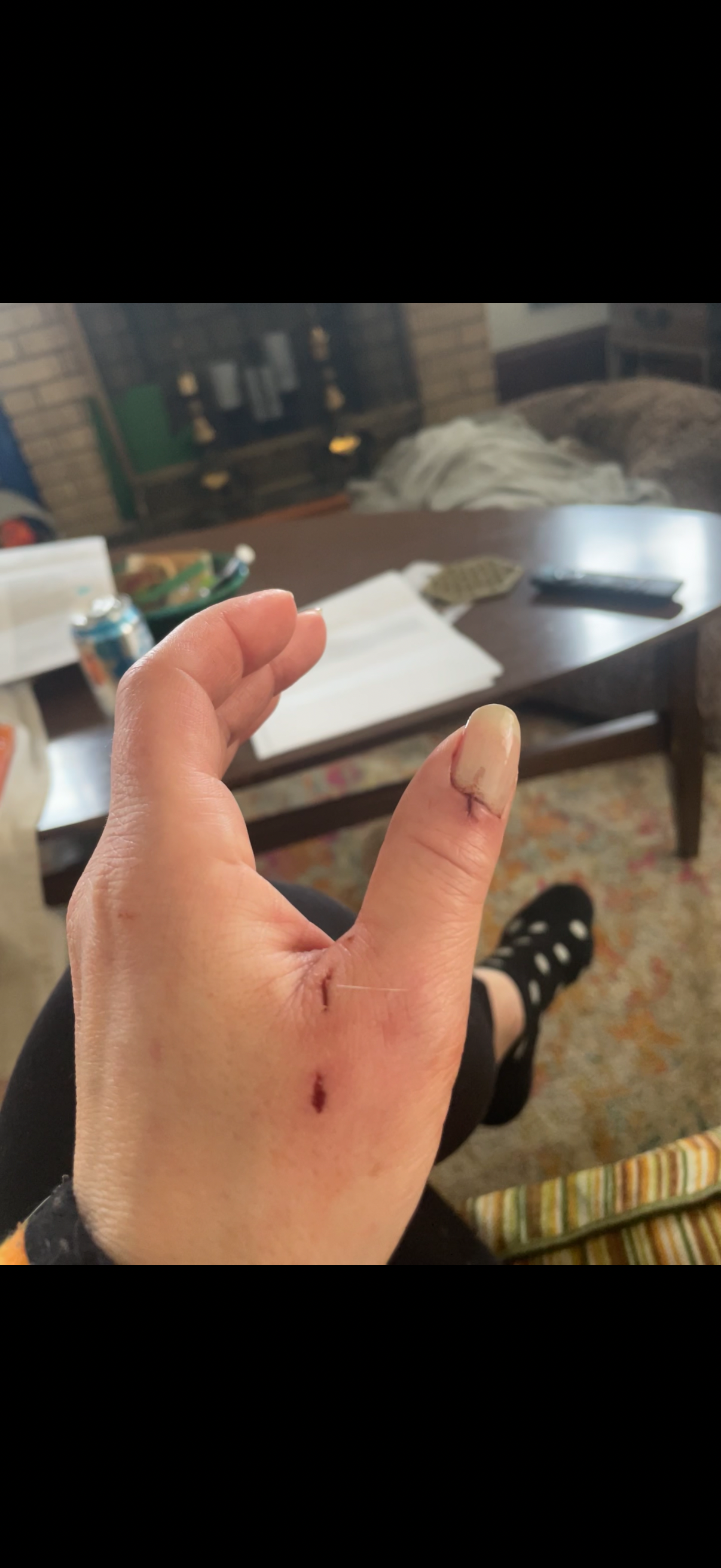 Help Danielle and Yogi Heal After Vicious Dog Attack campaign photo, 5 of 8