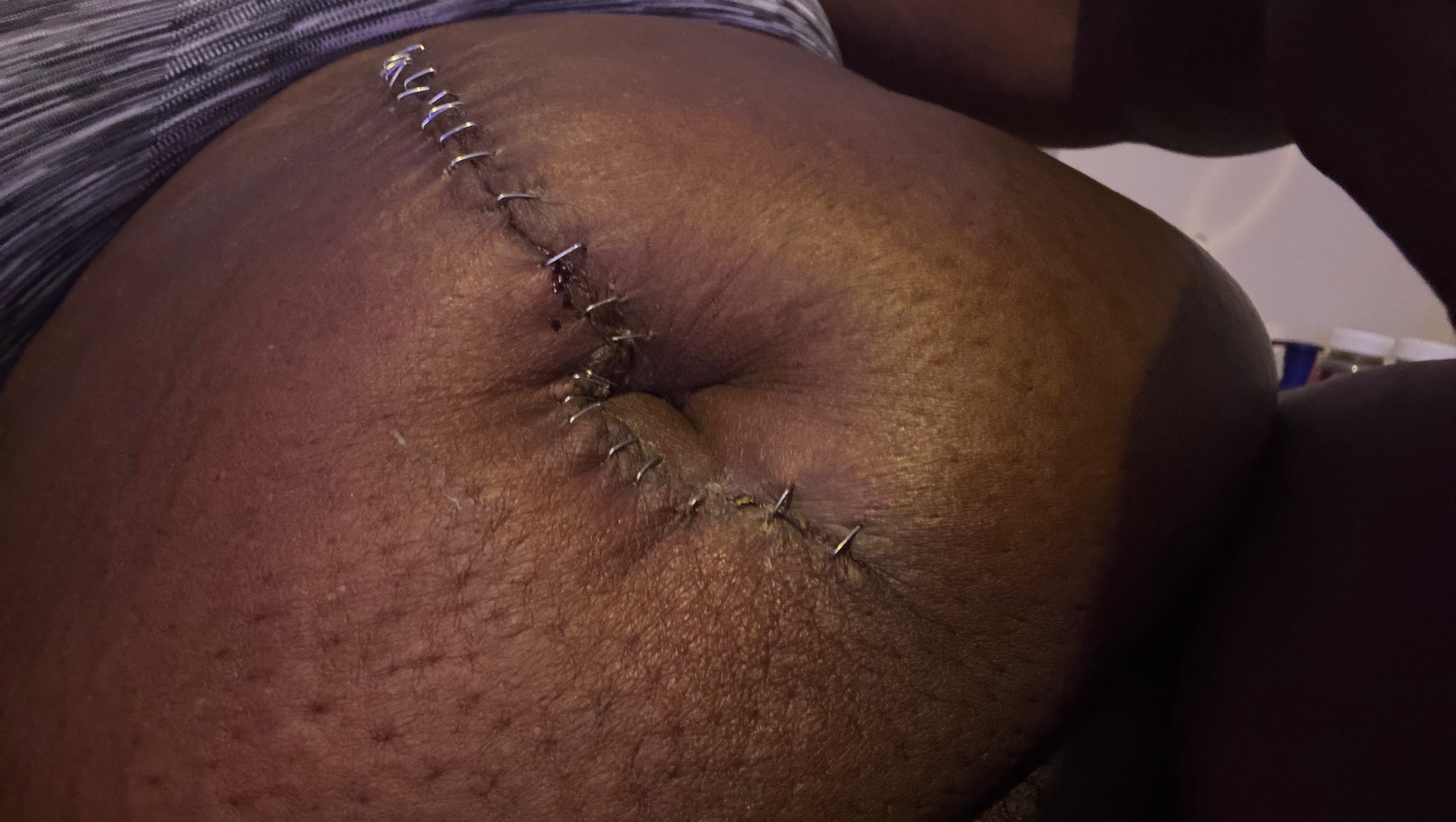 Help Rochelle Keep Her Home photo