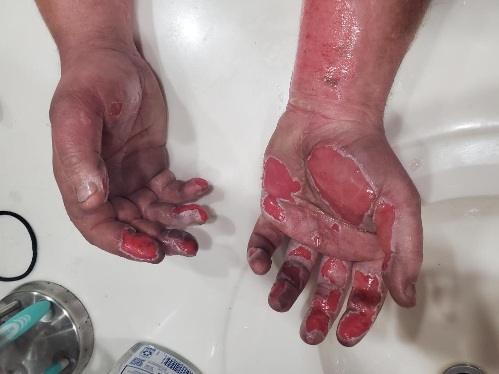 Help Brendon Booher Recover After A House Fire. campaign photo, 4 of 7