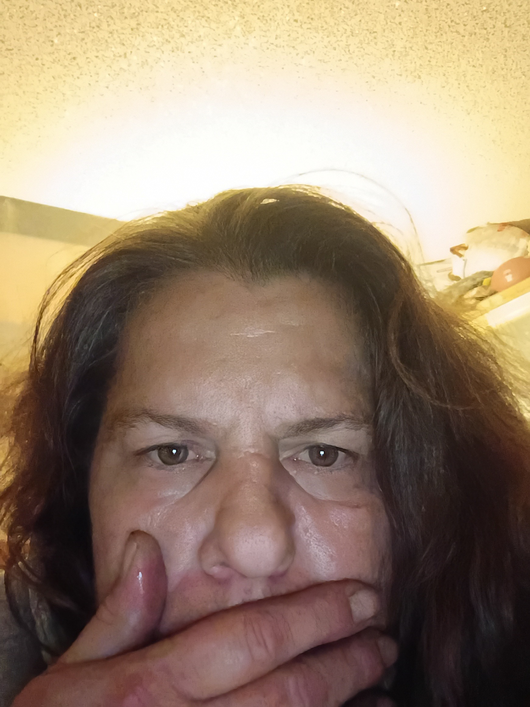 Help Kathryn Get Dental Implants campaign photo, 4 of 5