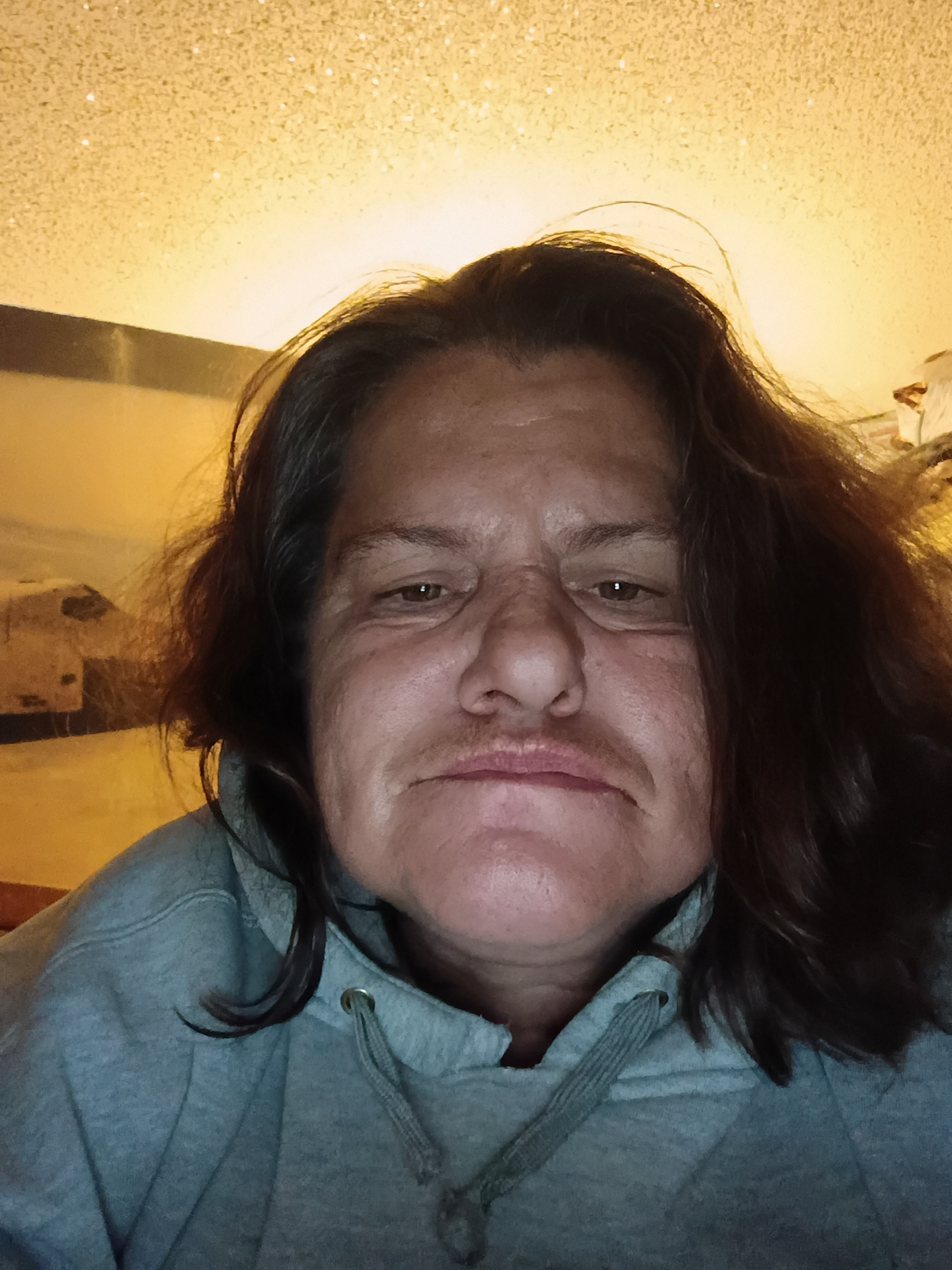 Help Kathryn Get Dental Implants campaign photo, 2 of 5