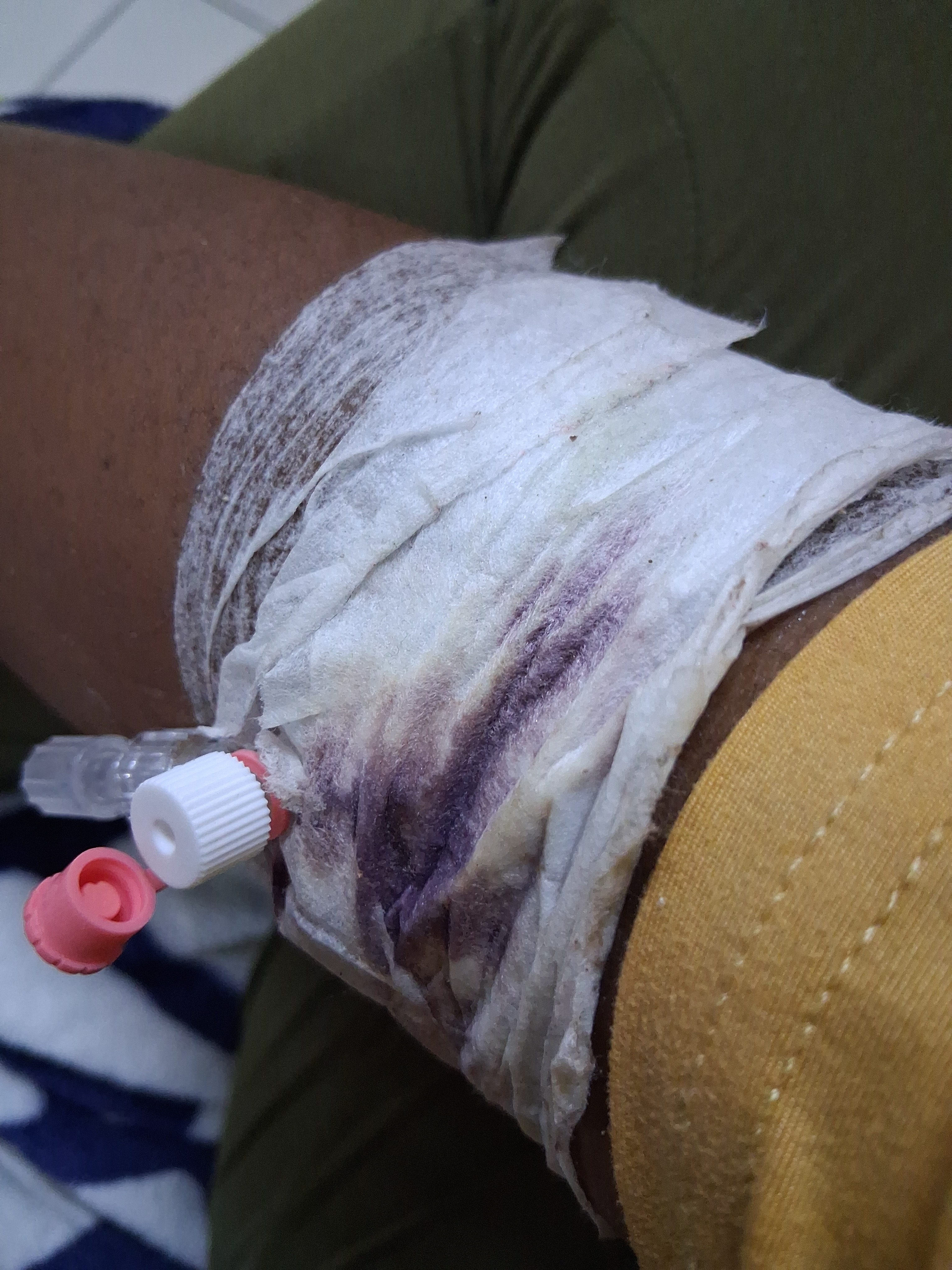 Title: Help Natisha Get Life-Saving Fibroid Surgery campaign photo, 2 of 4