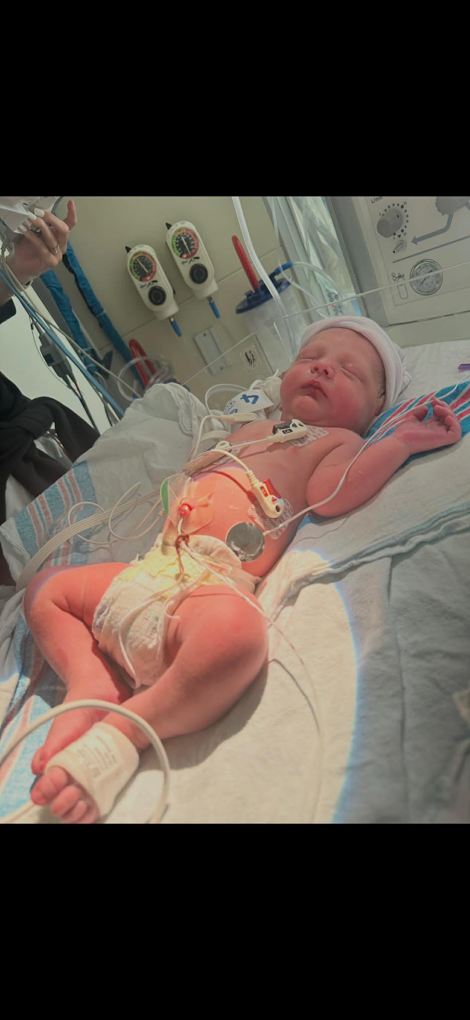 Baby Archer’s Heart Surgery Fund campaign photo, 2 of 4