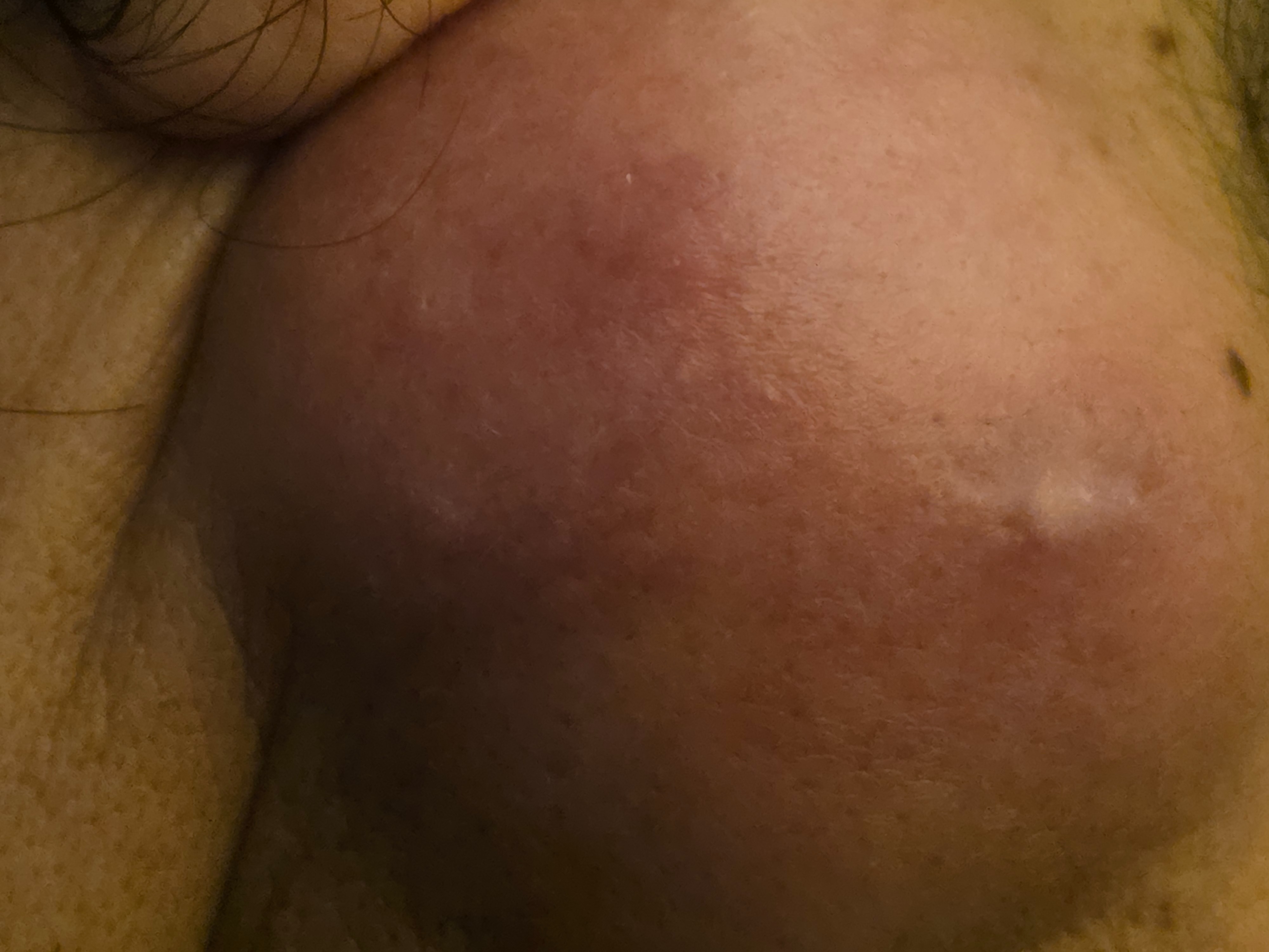 Support Sergio’s Cancer Recovery Journey campaign photo, 4 of 6