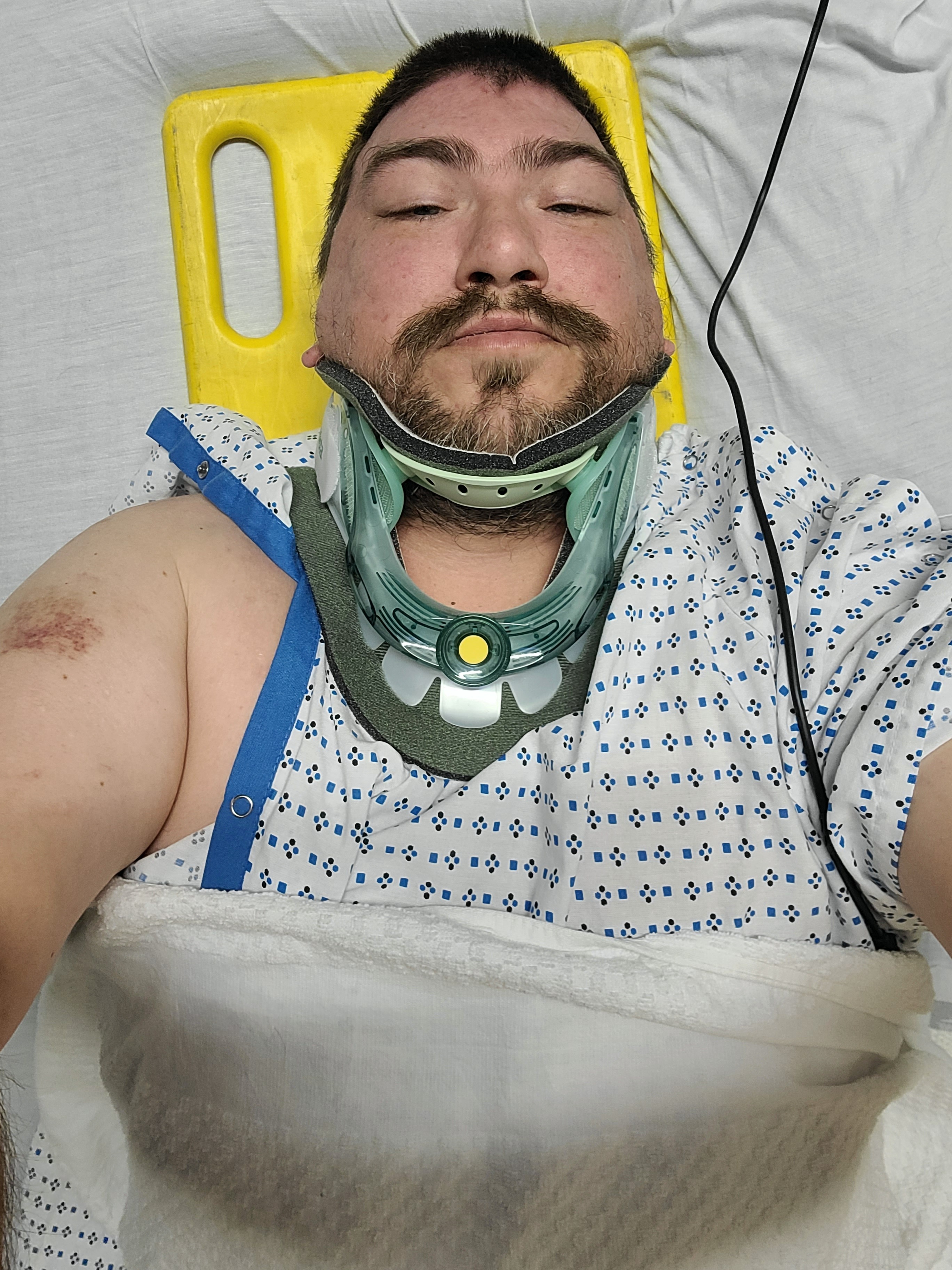 Support My Recovery After Spinal Fusion Surgery campaign photo, 2 of 5