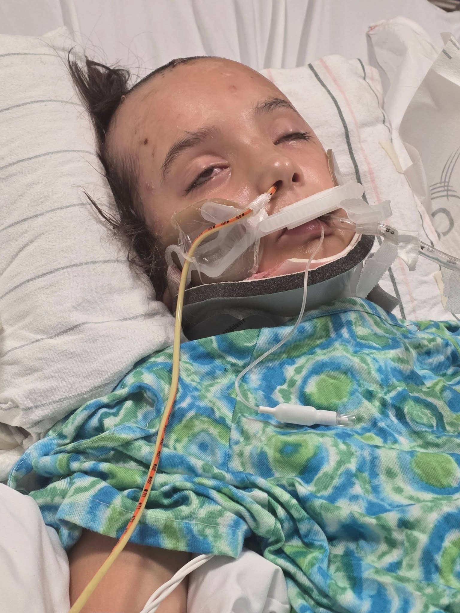 Support Scarlett’s Healing & Family Recovery campaign photo, 5 of 7