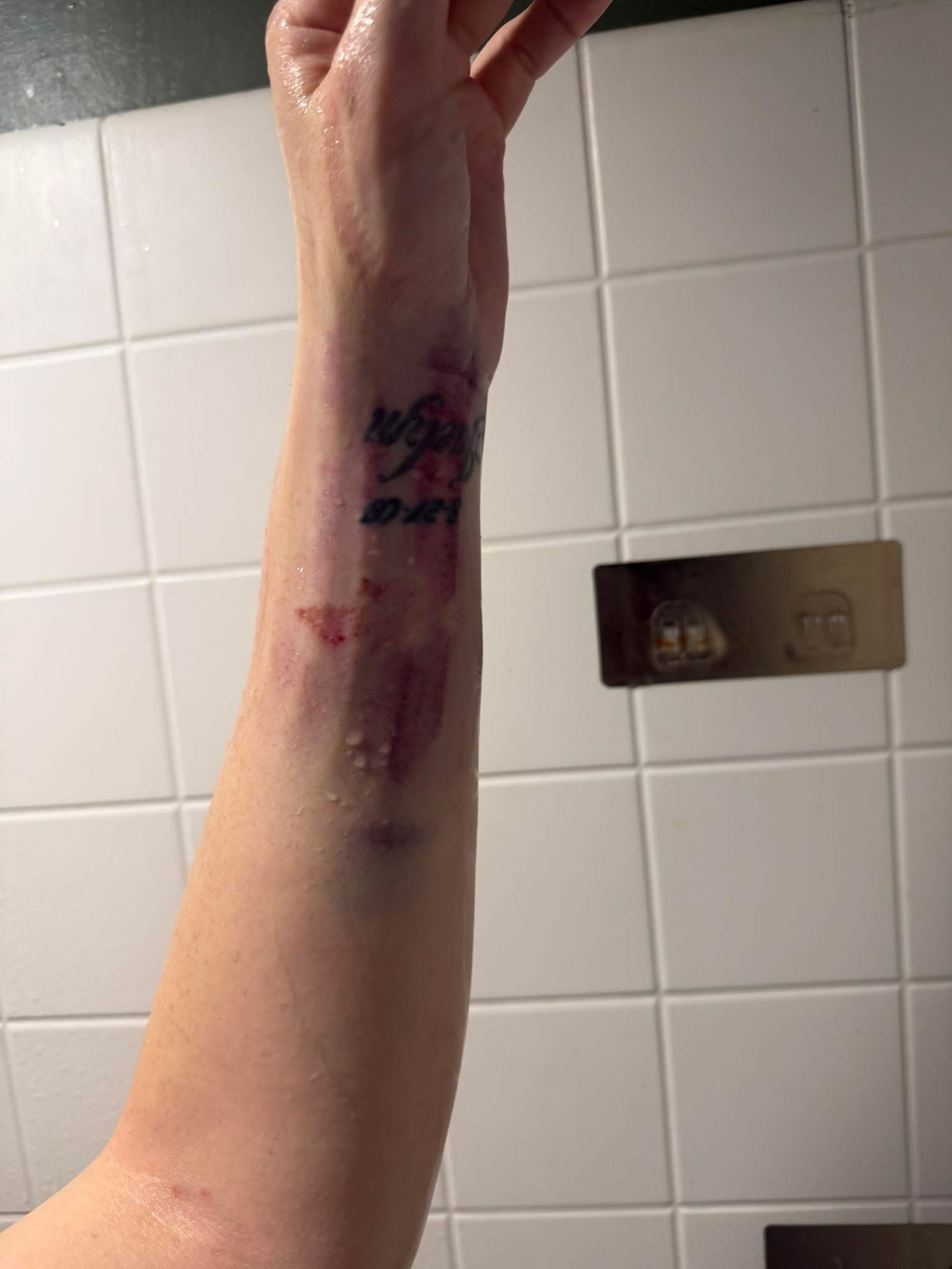 Support Brittney's Recovery After Car Accident campaign photo, 5 of 7