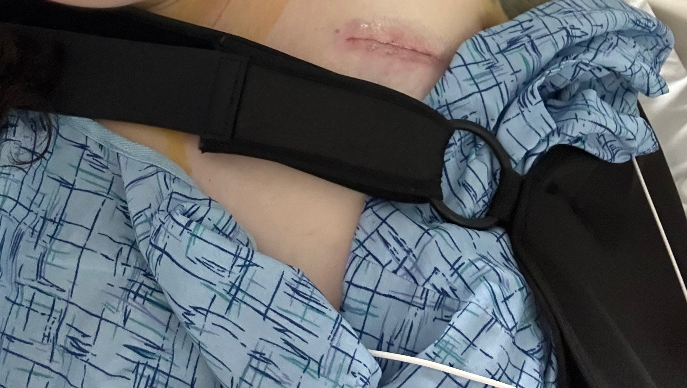 Help Caylin Get Lifesaving Heart Surgery photo