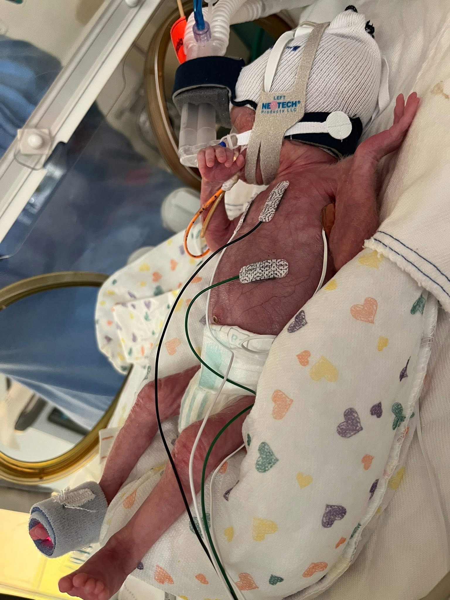 Support for Emoreigh’s NICU Journey campaign photo, 2 of 4