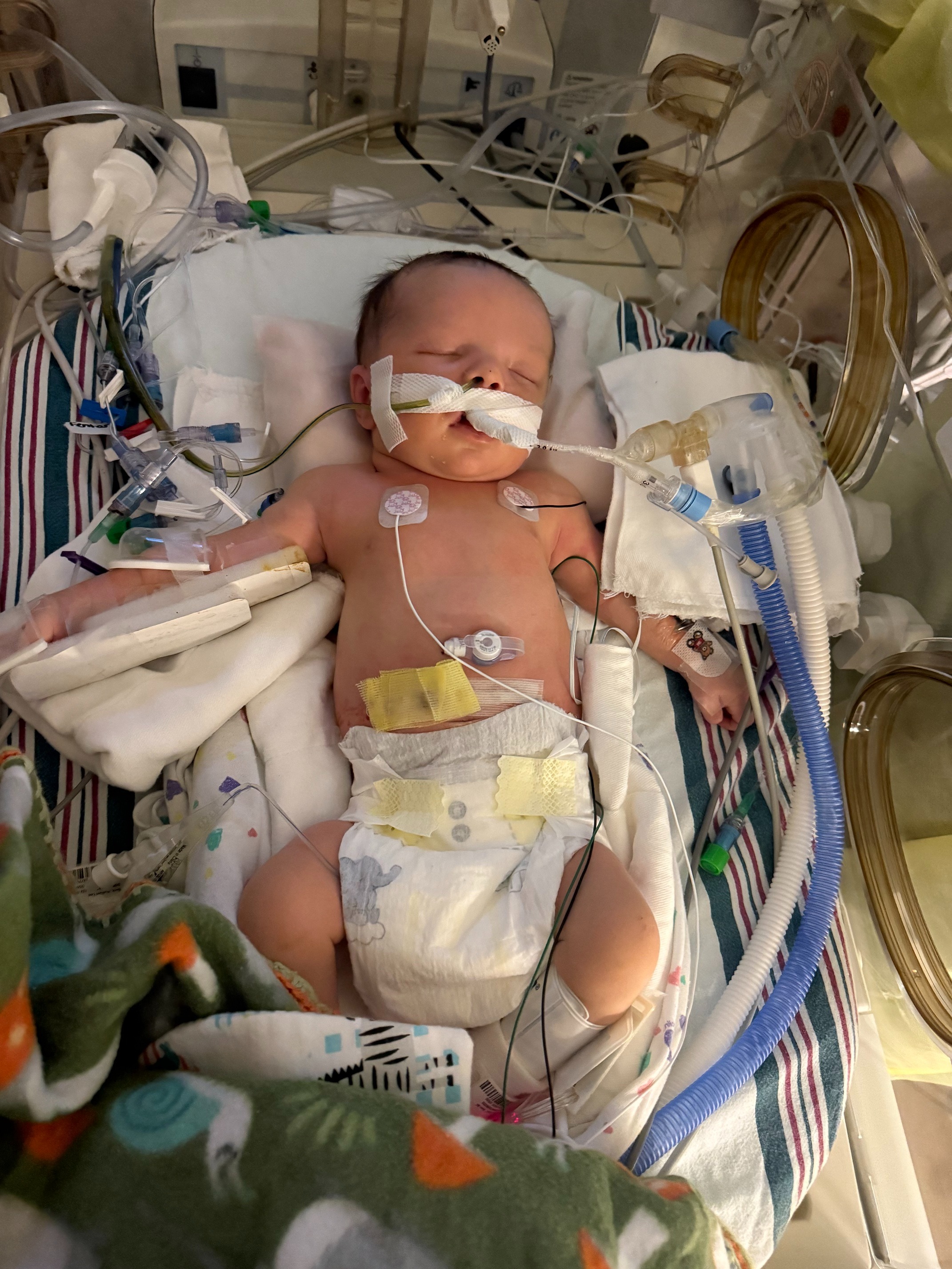 Hudson’s Fight: NICU Support After Surgery at 12 Days Old campaign photo, 4 of 5