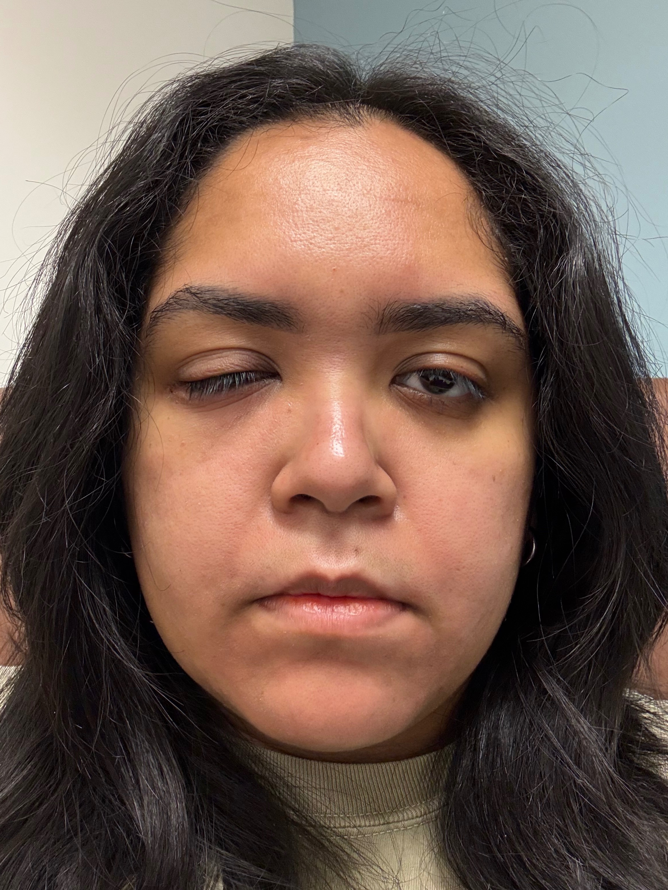Help Sherri Fight Peri Orbital Cellulitis campaign photo, 6 of 7