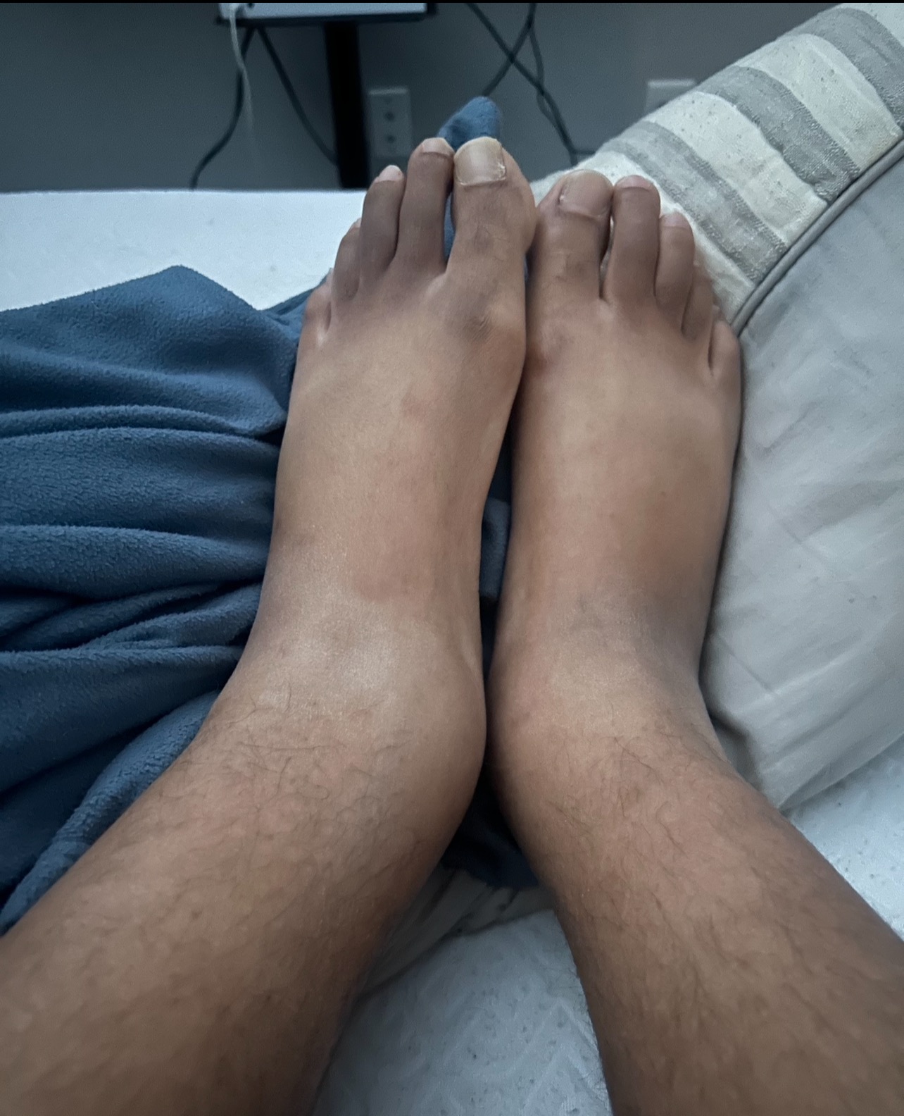 [Help] Diagnosed with Blood Clots (Medical Bills) campaign photo, 5 of 6