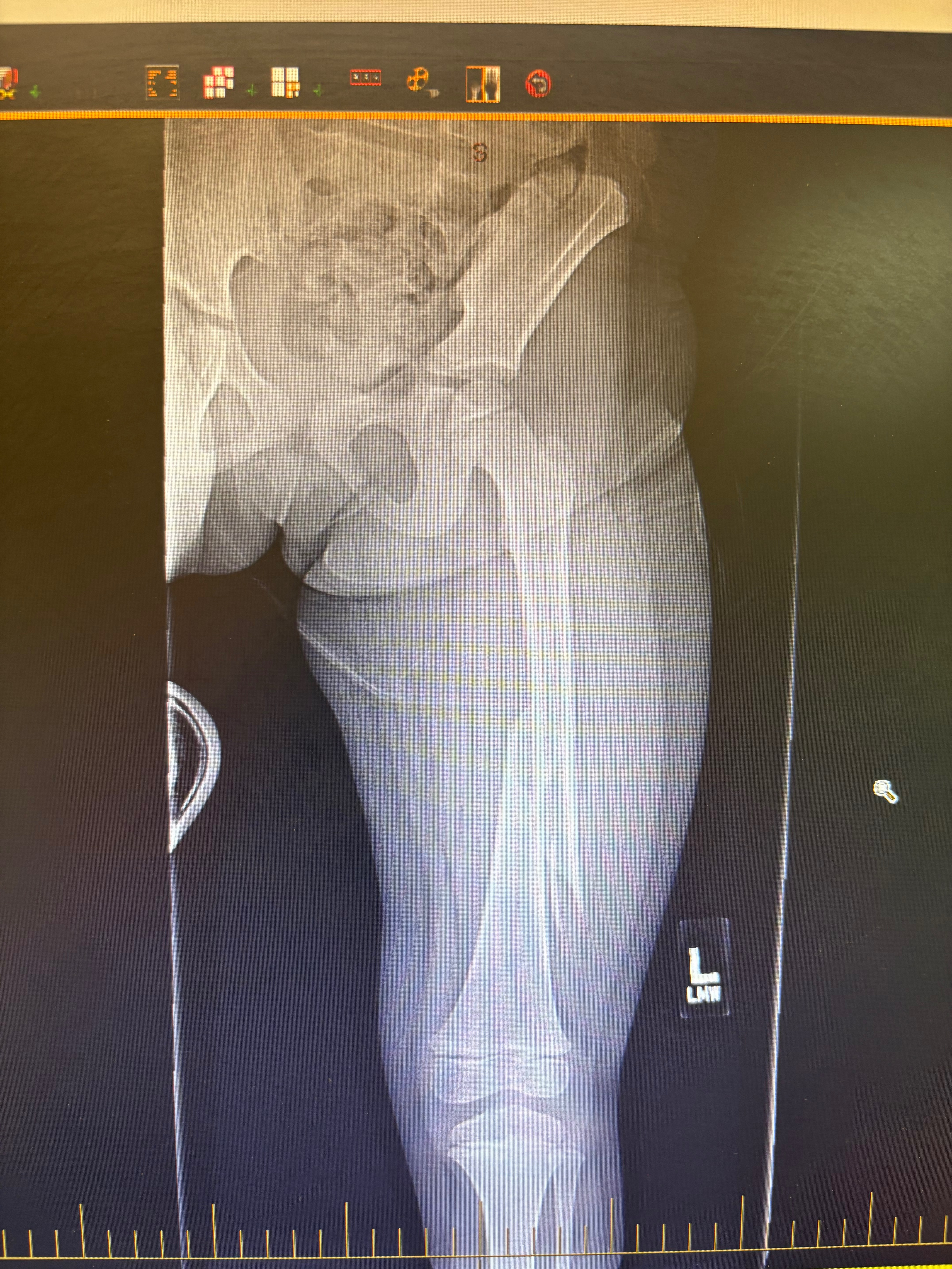 Easing Medical Costs for Kollins' Healing campaign photo, 4 of 5