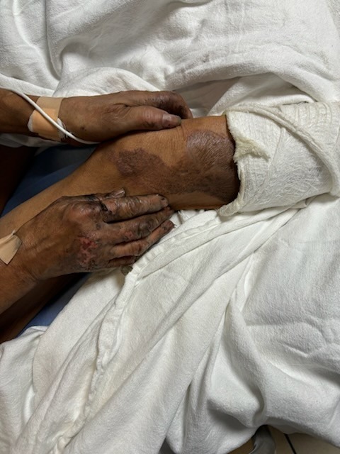 Help Beryl After a Devastating House Fire campaign photo, 5 of 7