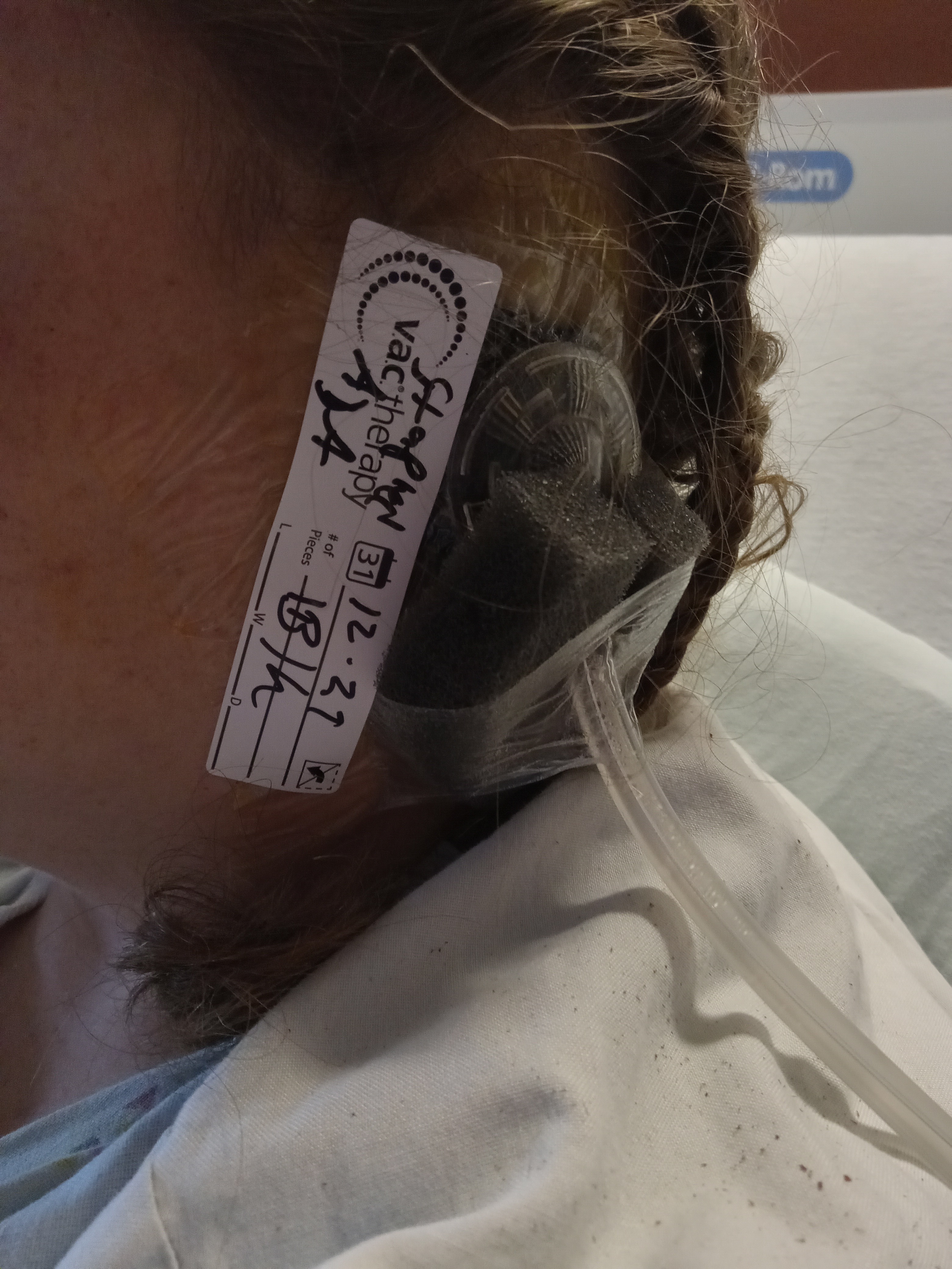 Help Amanda Kern during her recovery! campaign photo, 6 of 7