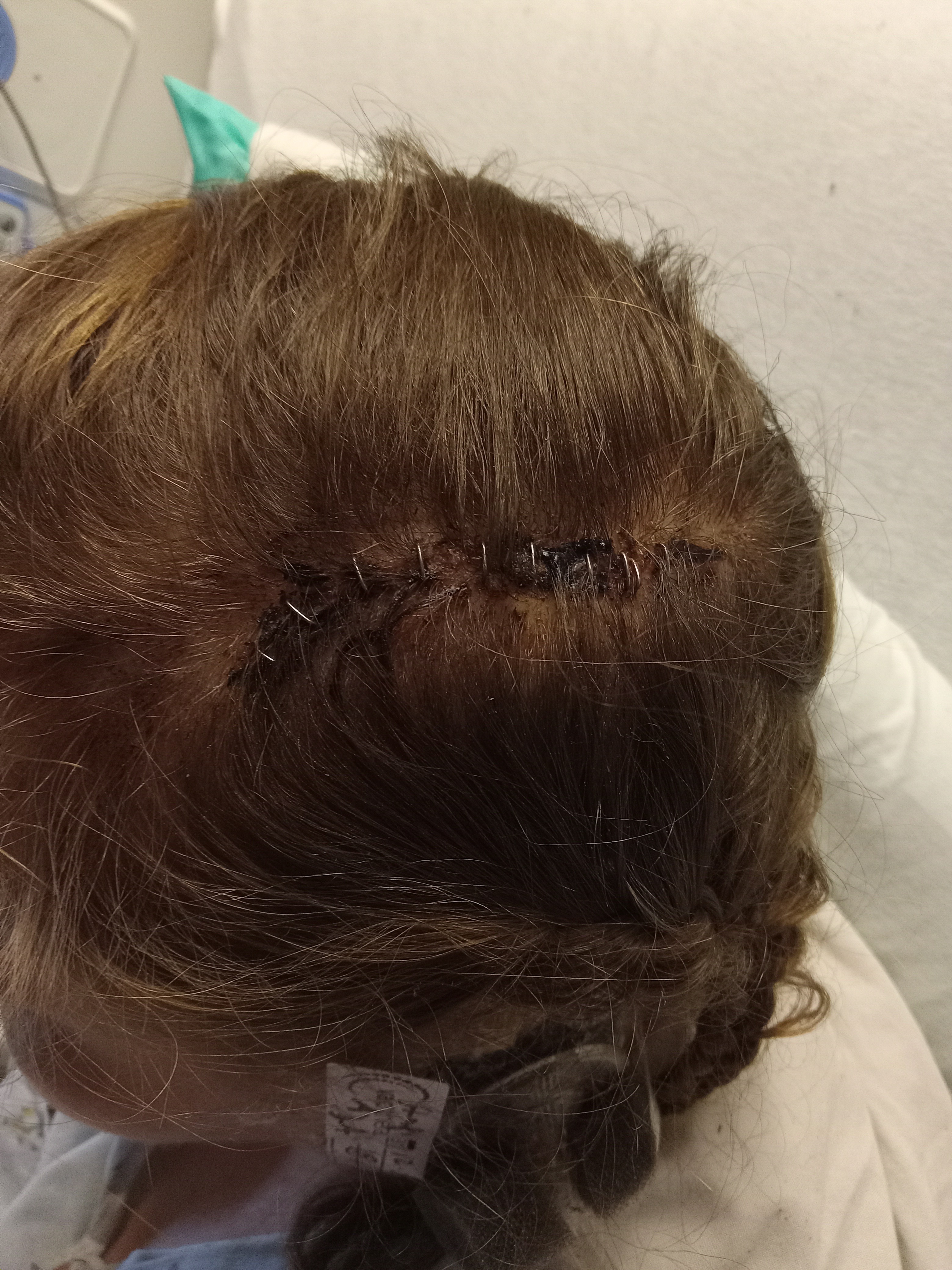 Help Amanda Kern during her recovery! campaign photo, 2 of 7