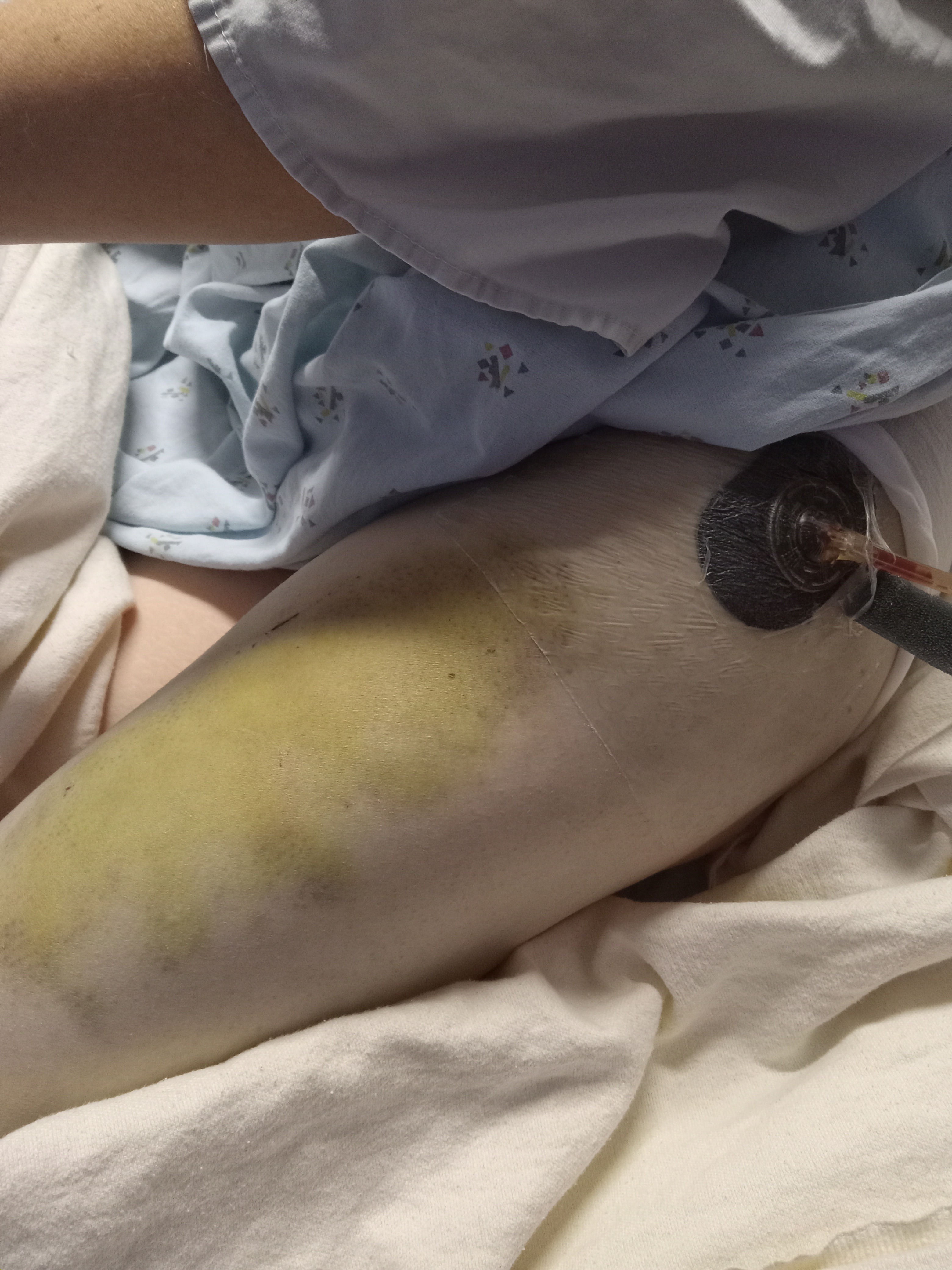 Help Amanda Kern during her recovery! campaign photo, 4 of 7