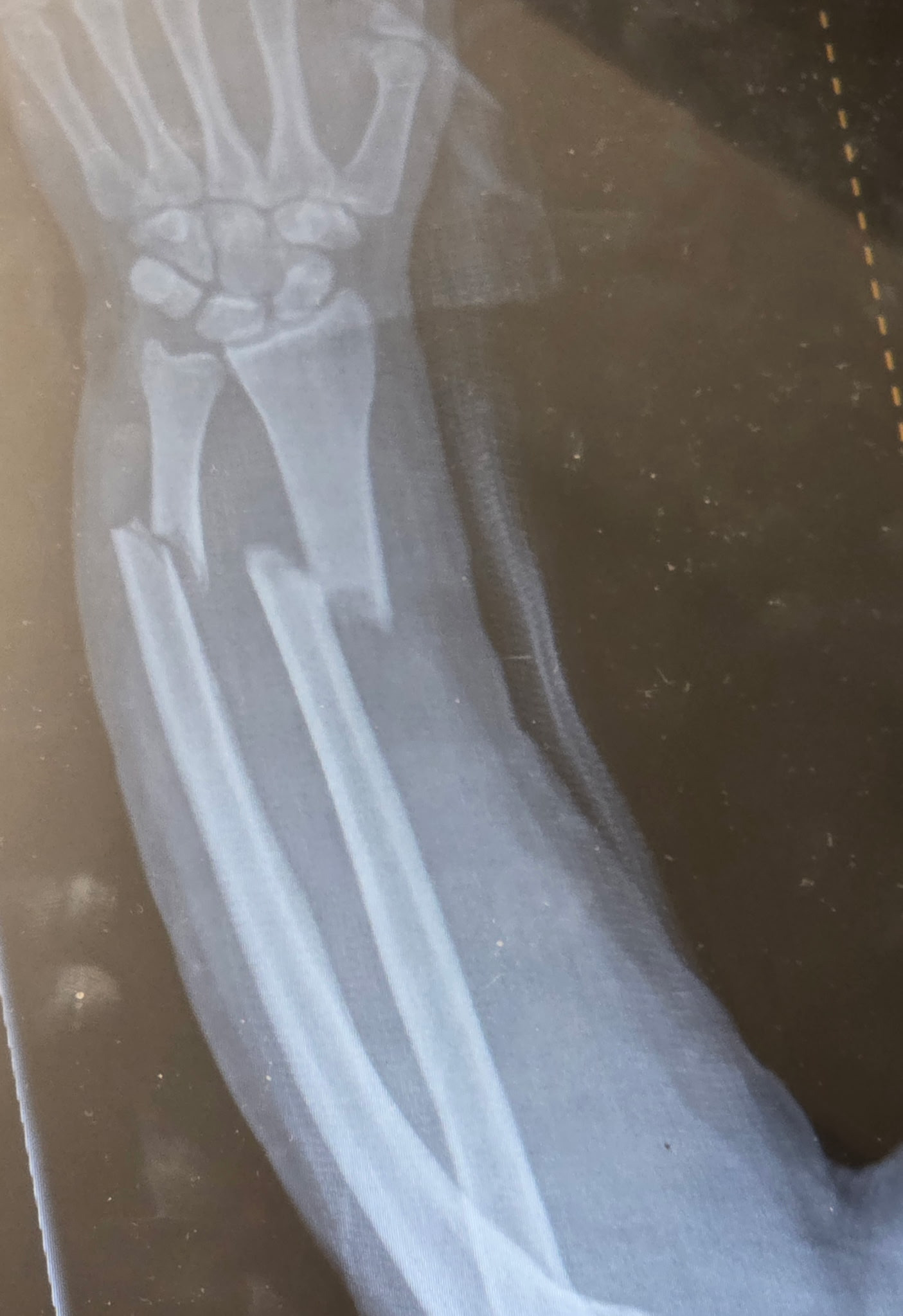 Help Gene IV Recover from His Scooter Accident campaign photo, 2 of 4