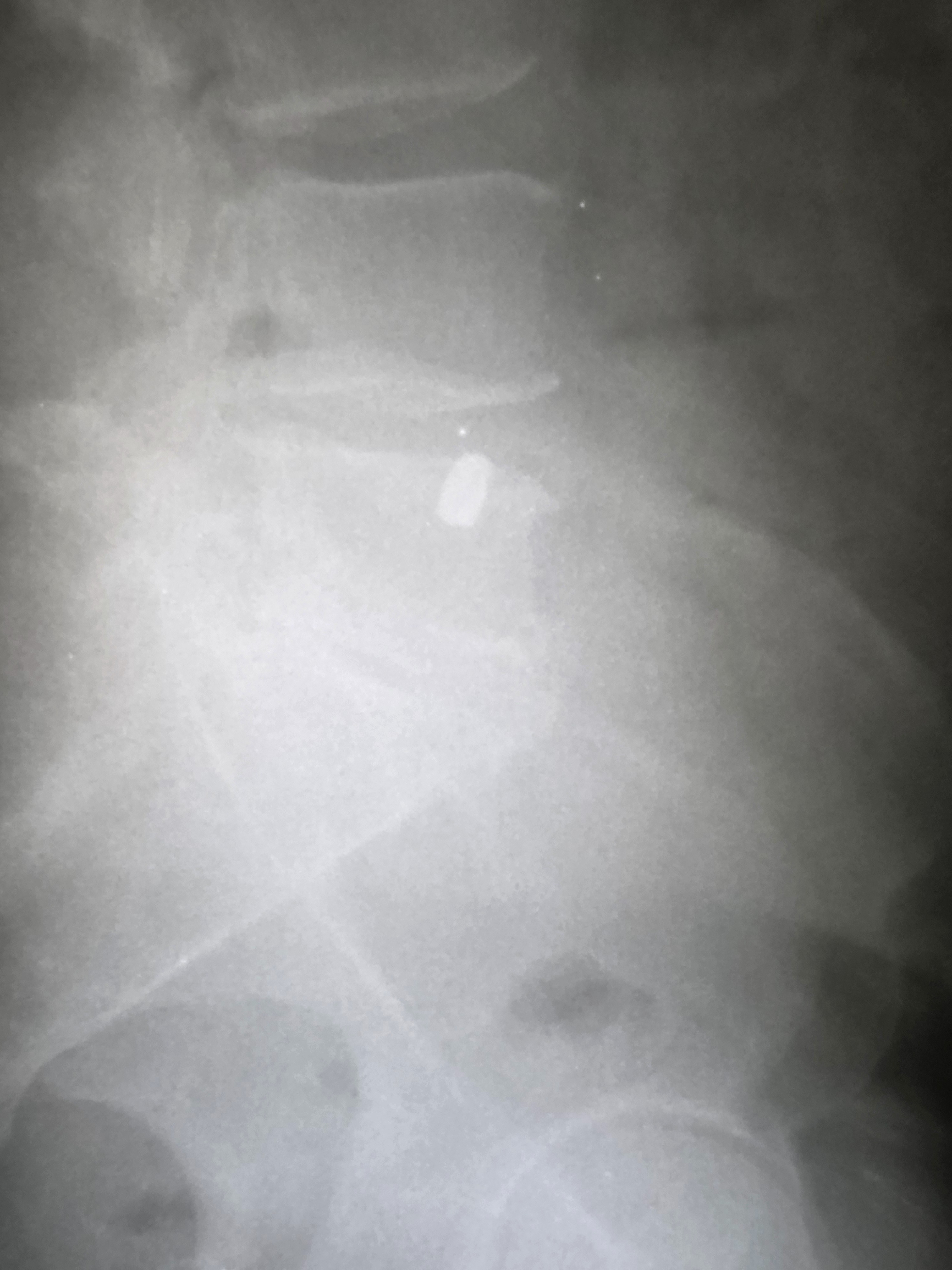 Help Michael Recover After Back Surgery campaign photo, 5 of 6