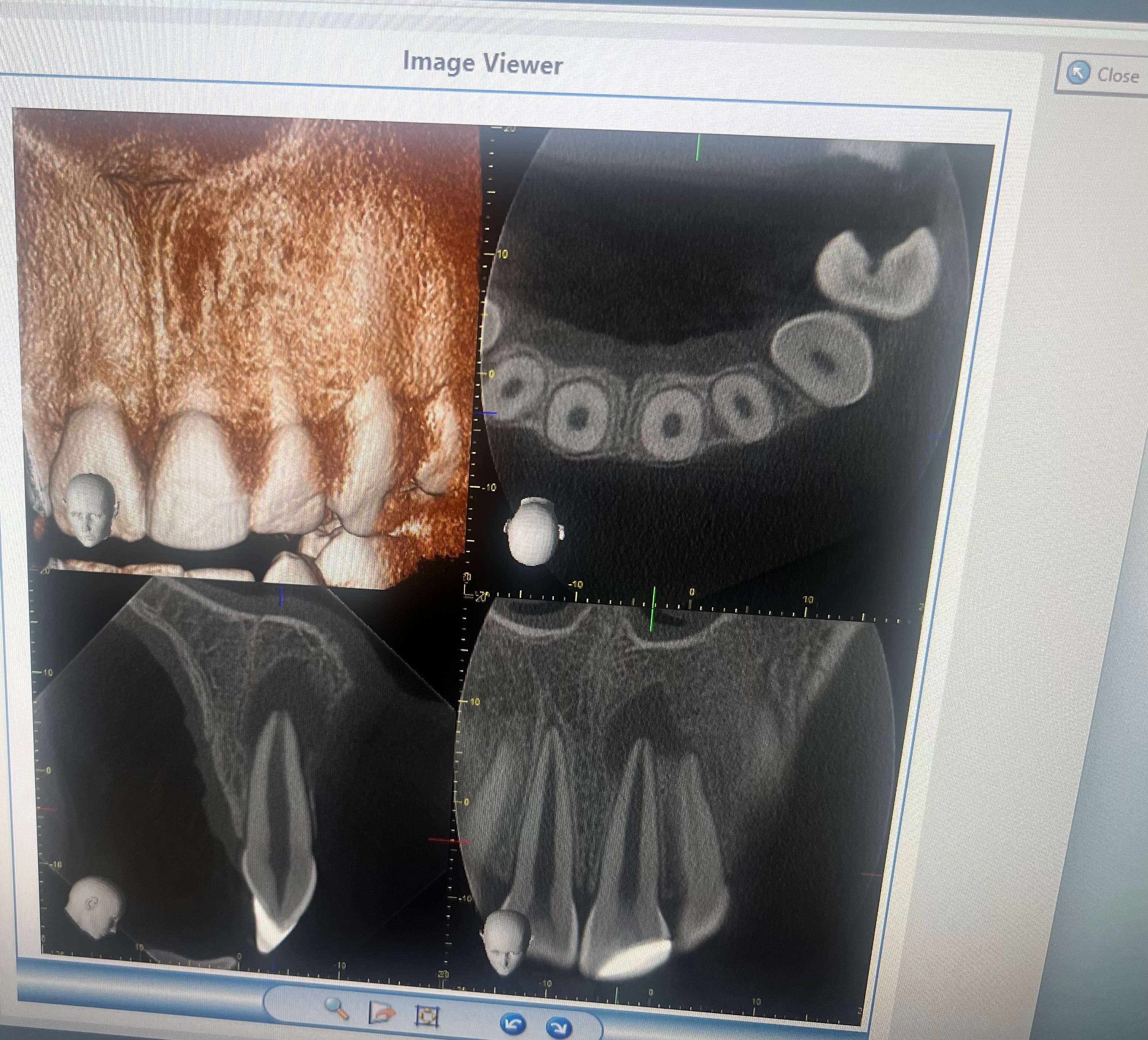 Support for My Brother’s Urgent Dental Surgery campaign photo, 2 of 5