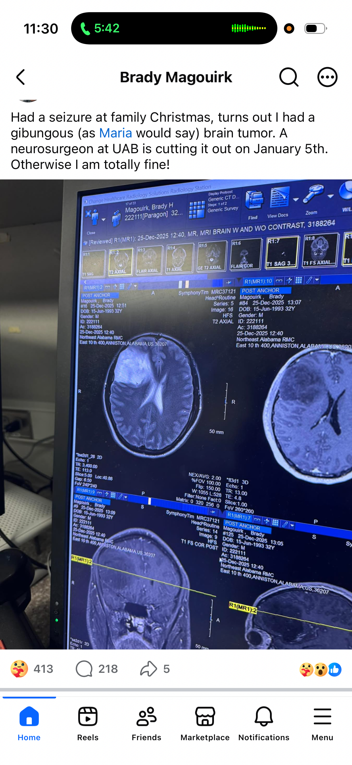 Support for Brady’s Brain Surgery & Recovery campaign photo, 2 of 8