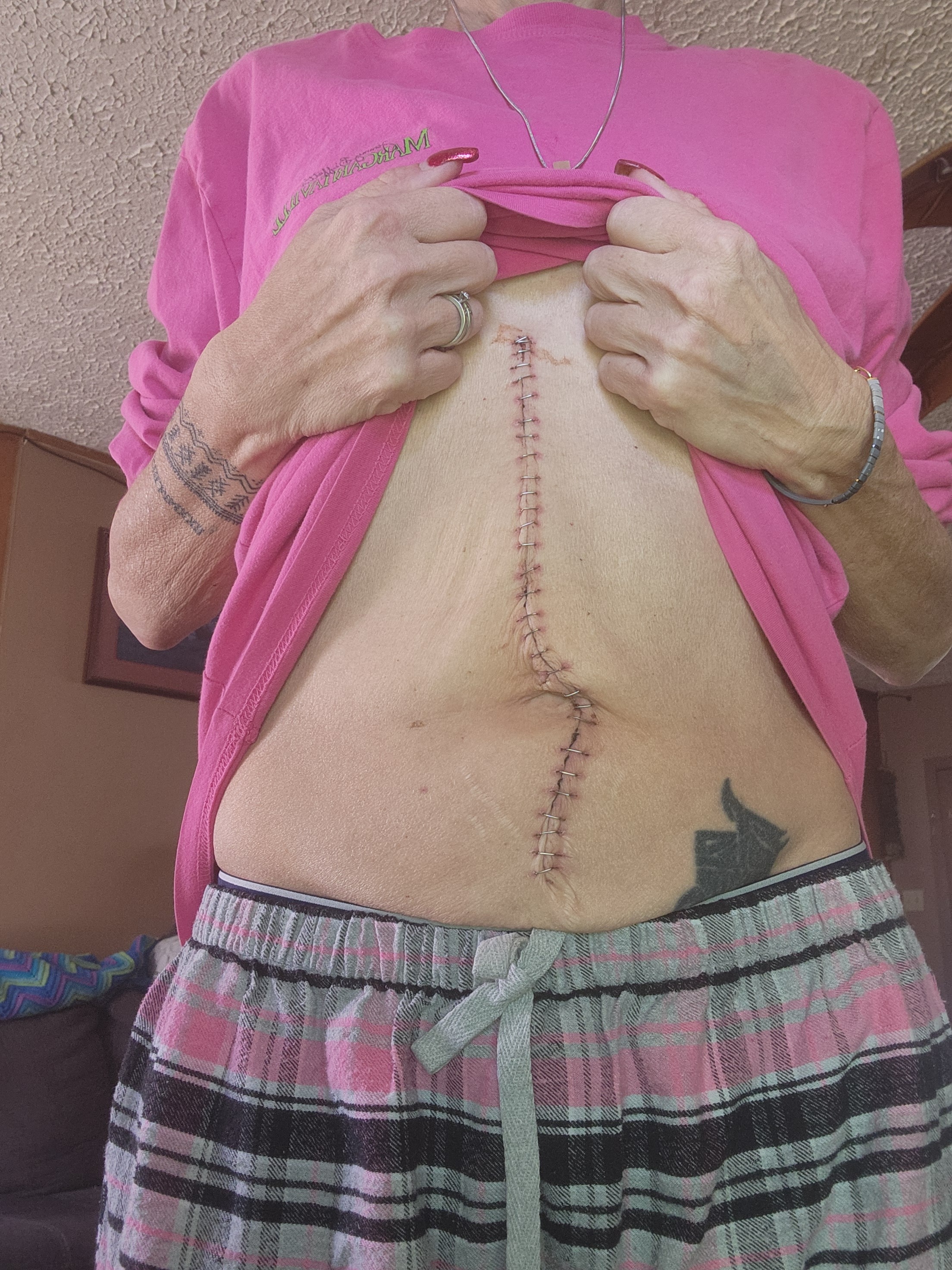 Help Claudette Recover After Life Saving Surgery campaign photo, 7 of 8