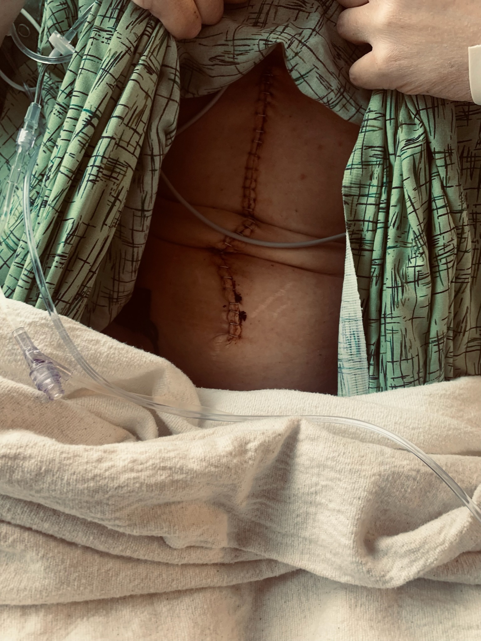 Help Claudette Recover After Life Saving Surgery campaign photo, 2 of 8