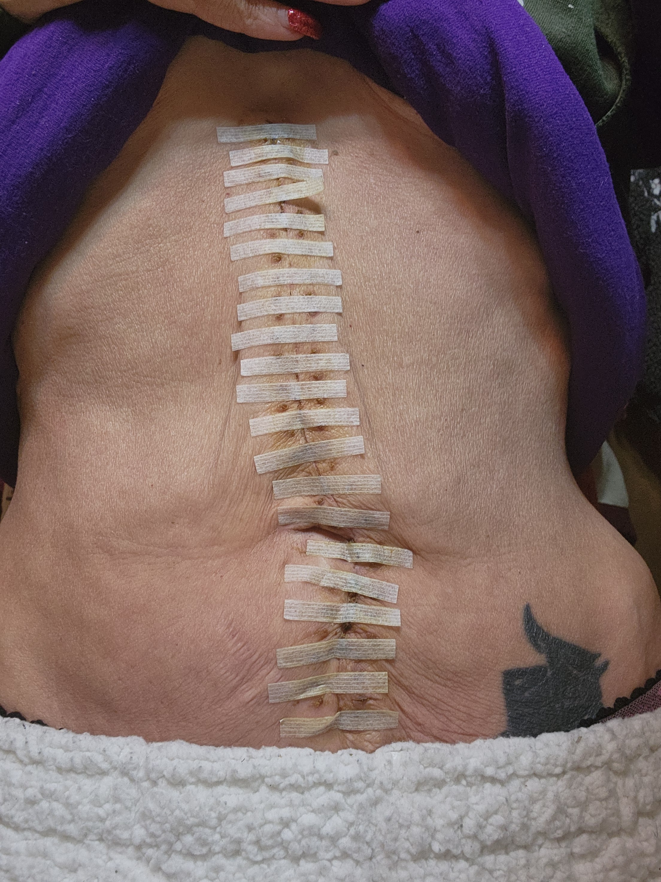 Help Claudette Recover After Life Saving Surgery campaign photo, 6 of 8
