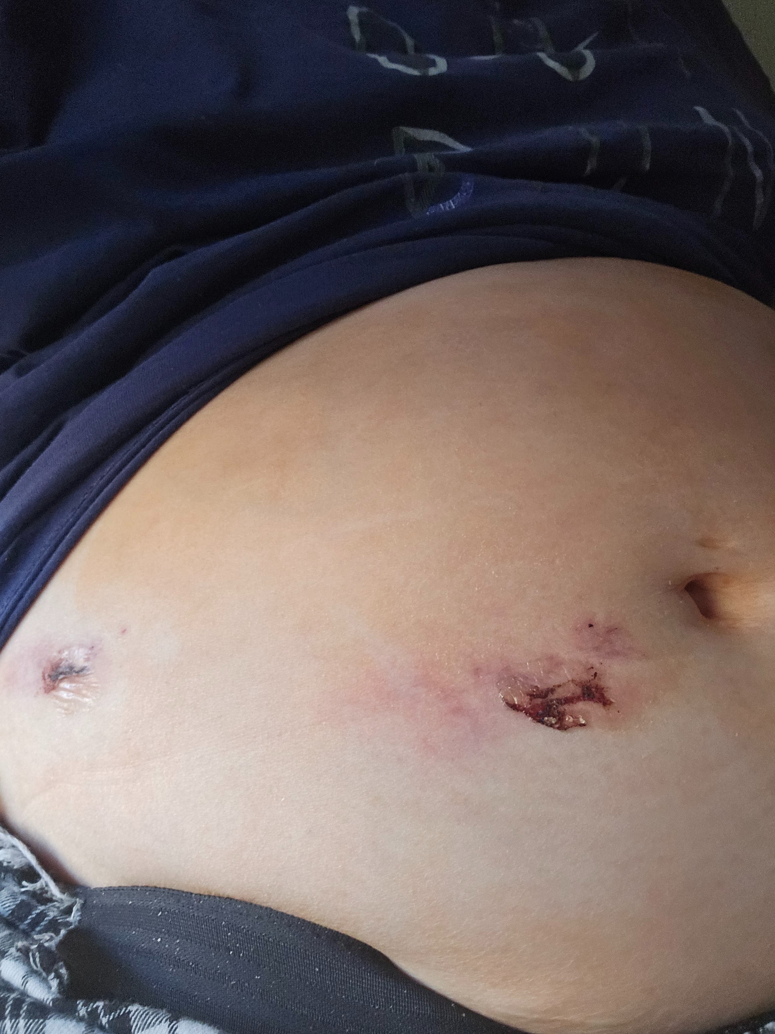 Support Needed for Critical Health and Eviction Crisis campaign photo, 2 of 8