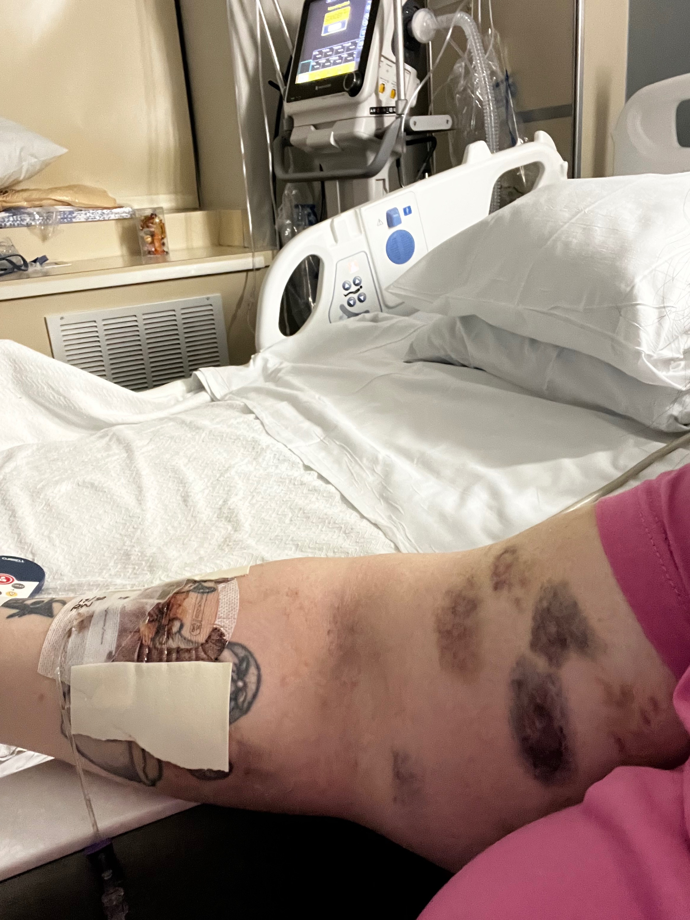 Support Rachel’s Recovery and Medical Care campaign photo, 5 of 7