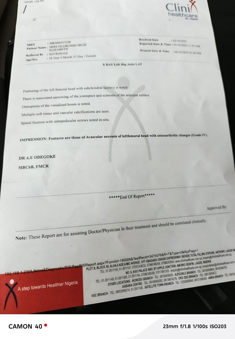 Urgent Help Needed for Life-Saving Spine, Hip, Surgeries campaign photo, 5 of 8