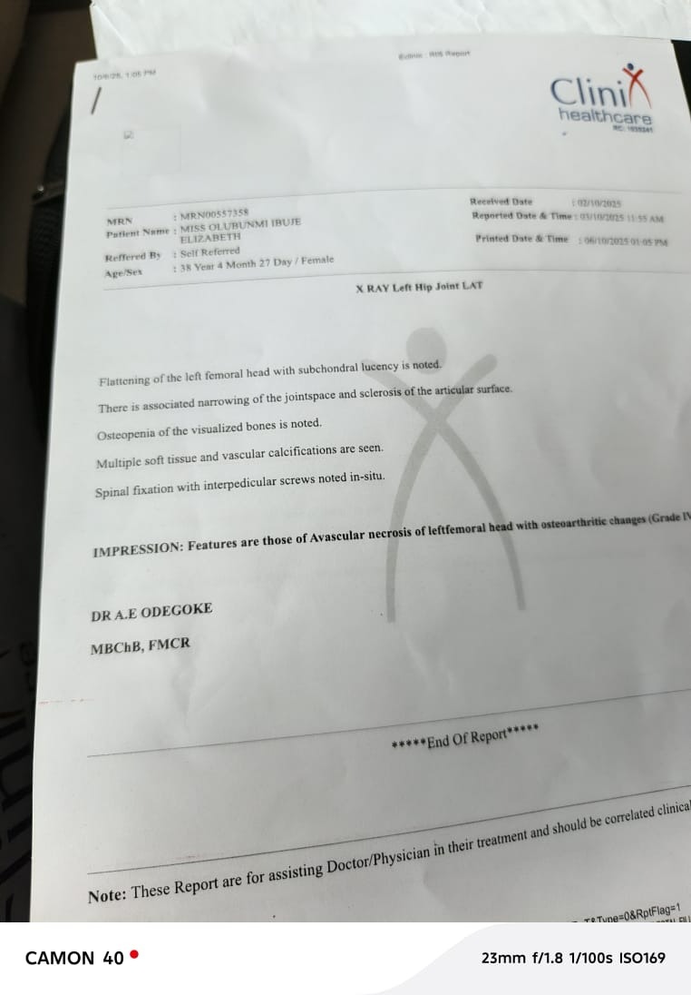 Urgent Help Needed for Life-Saving Spine, Hip, Surgeries campaign photo, 6 of 8