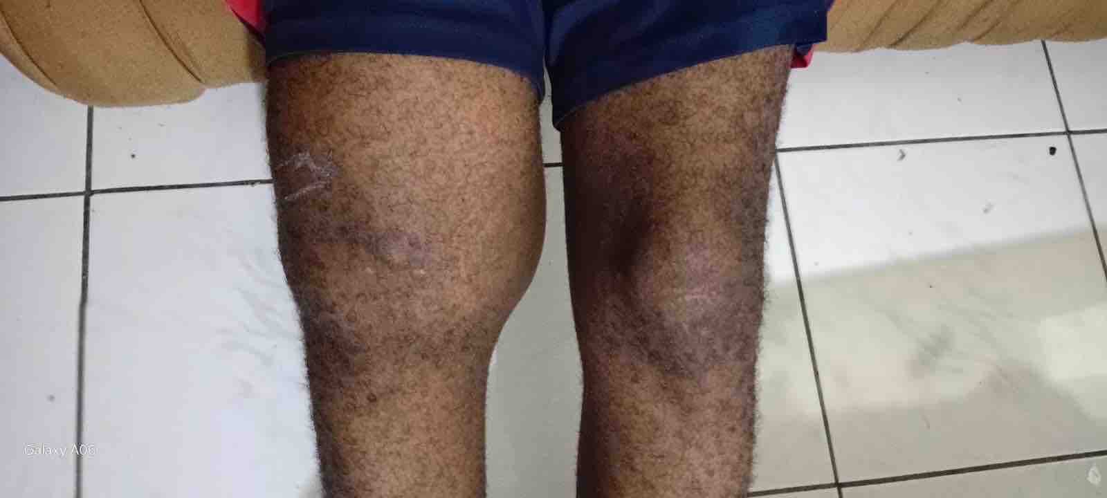 Support for Tracy-Ann's Son's Urgent Knee Surgery